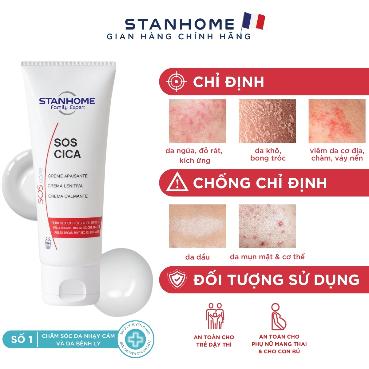Lưu ý khi dùng Kem Stanhome Sos Cica