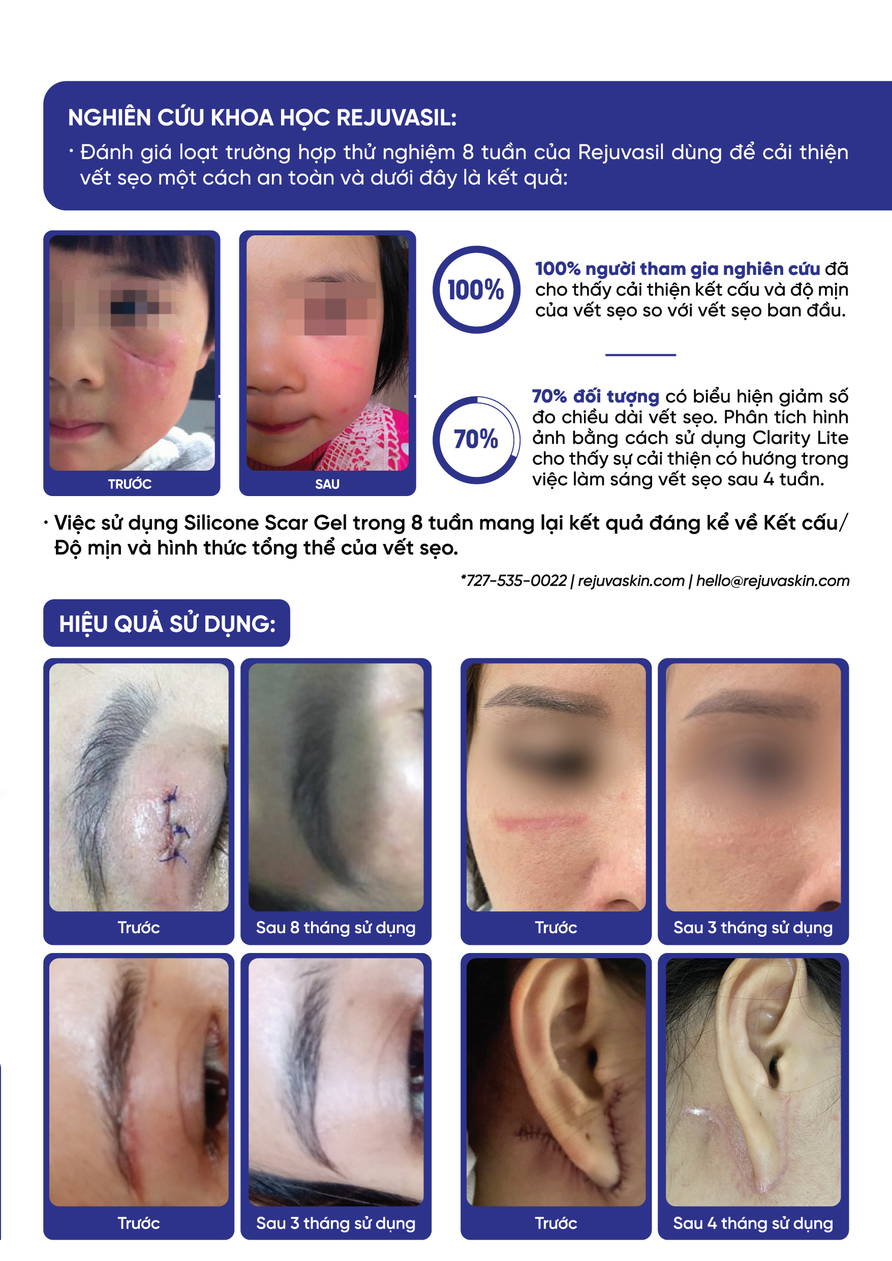 Mô tả Combo Gel ngăn ngừa sẹo và làm xẹp sẹo lồi, sẹo phì đại REJUVASKIN Rejuvasil 10ml/tuyp - 5