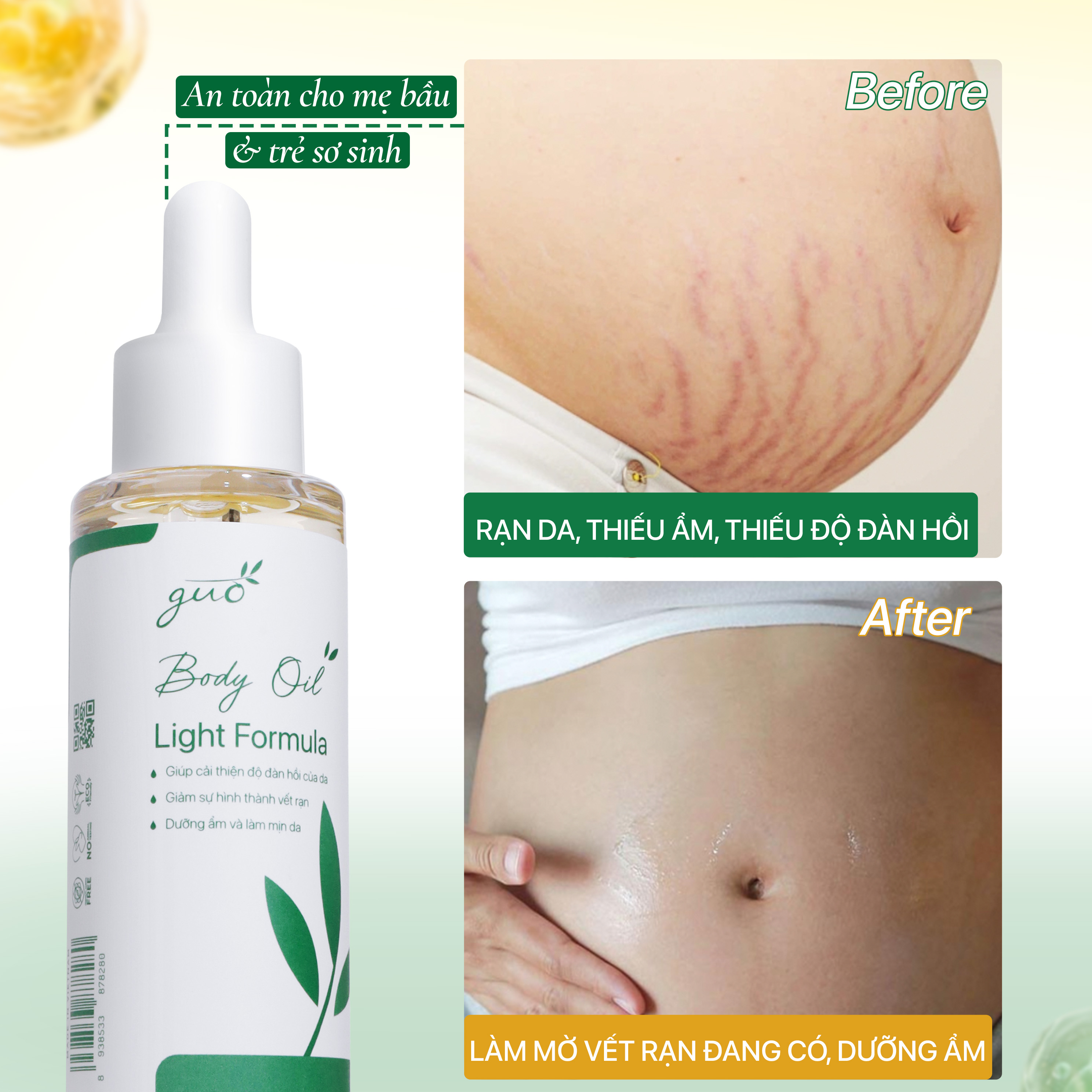 Mô tả Dầu Rạn Da Giảm Ngứa Dưỡng Ẩm Cho Bà Bầu & Mẹ Sau Sinh Lỏng Nhẹ Thấm Nhanh - GUO Body Light Oil Fomular - 2