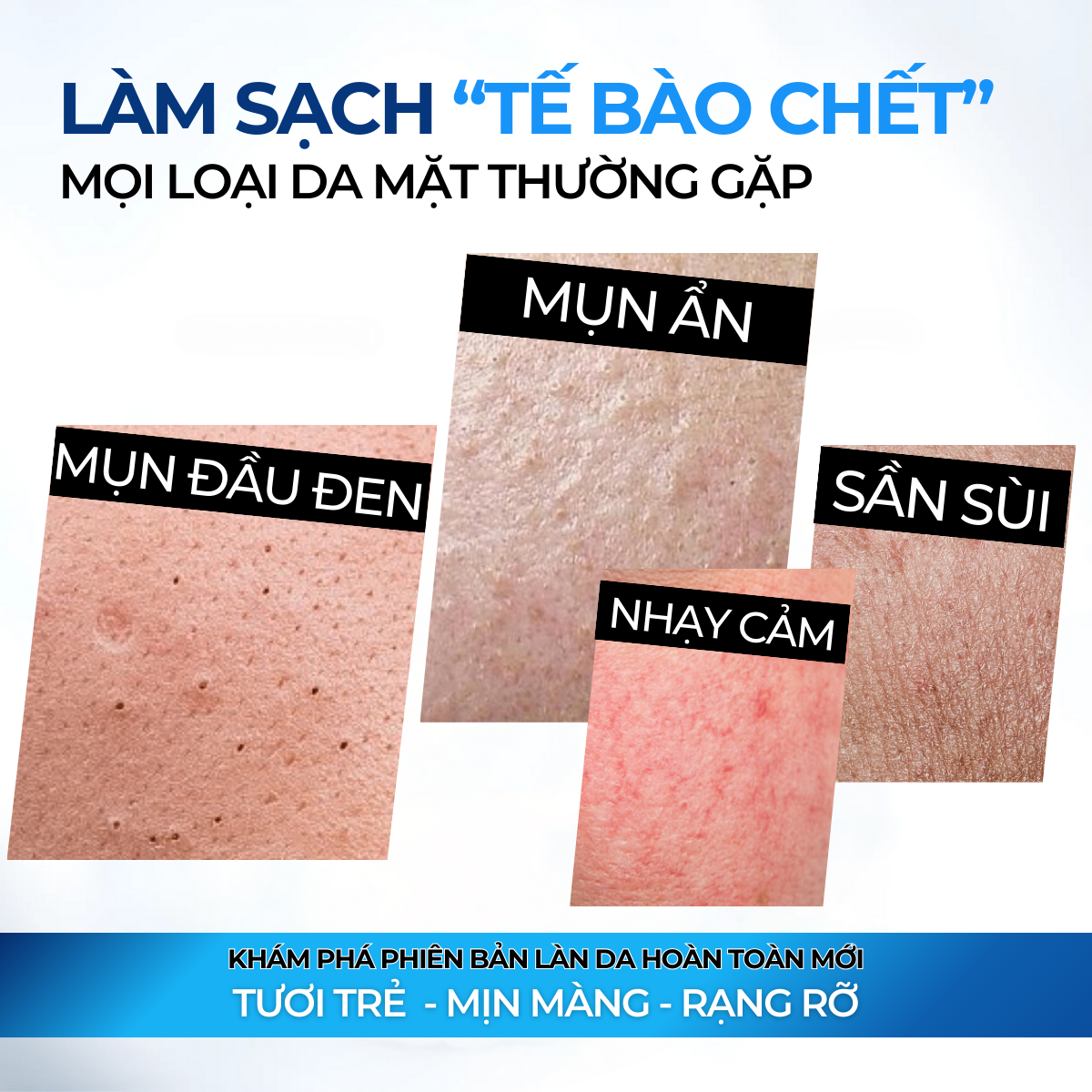 Mô tả Tẩy Tế Bào Chết Bha Compliment Giúp Làn Da Căng Bóng, Mịn Màng, Hỗ Trợ Thu Nhỏ Lỗ Chân Lông - 6