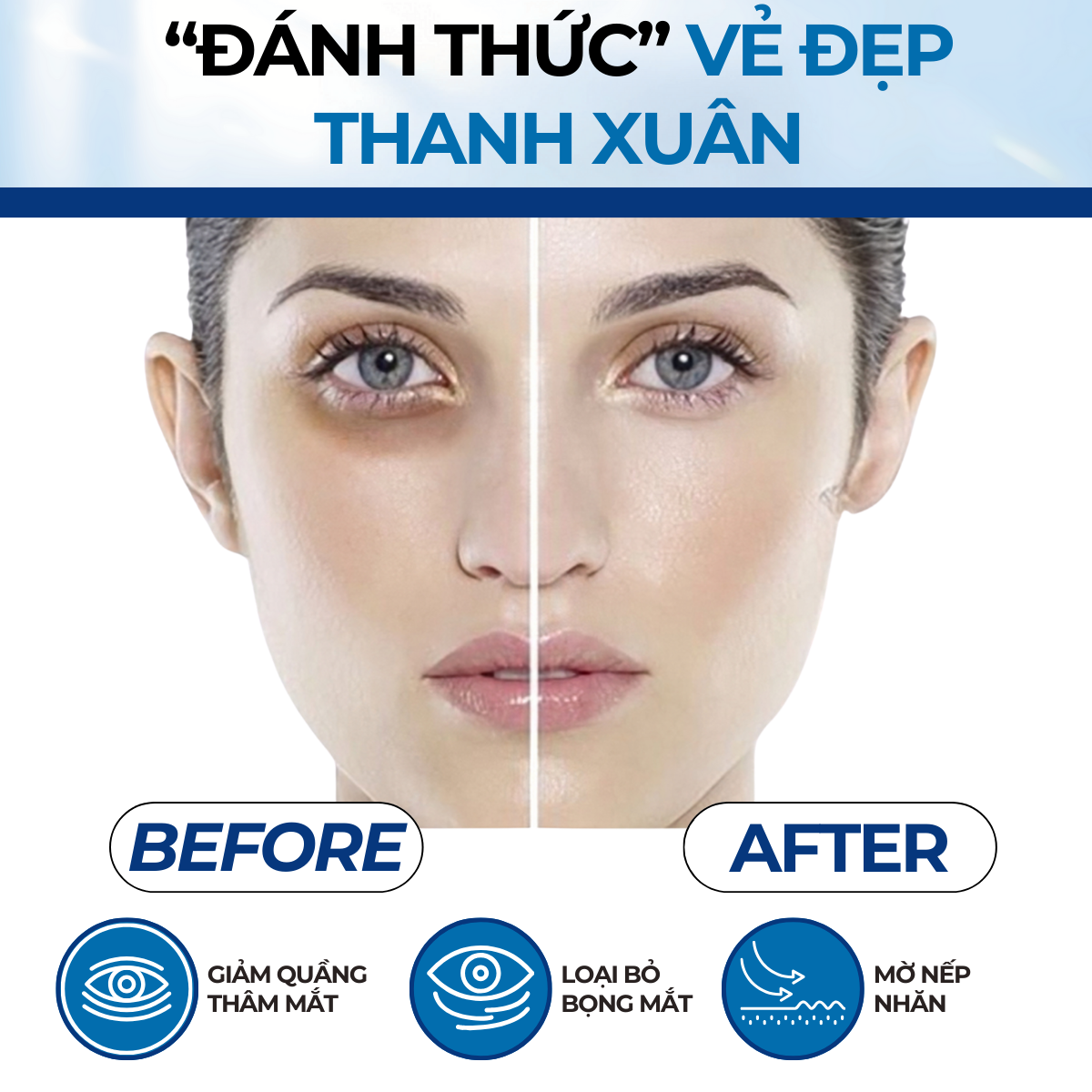Mô tả Thanh Lăn Giảm Thâm Quầng Mắt, Mỏi Mắt Compliment Eye 11ml - 5