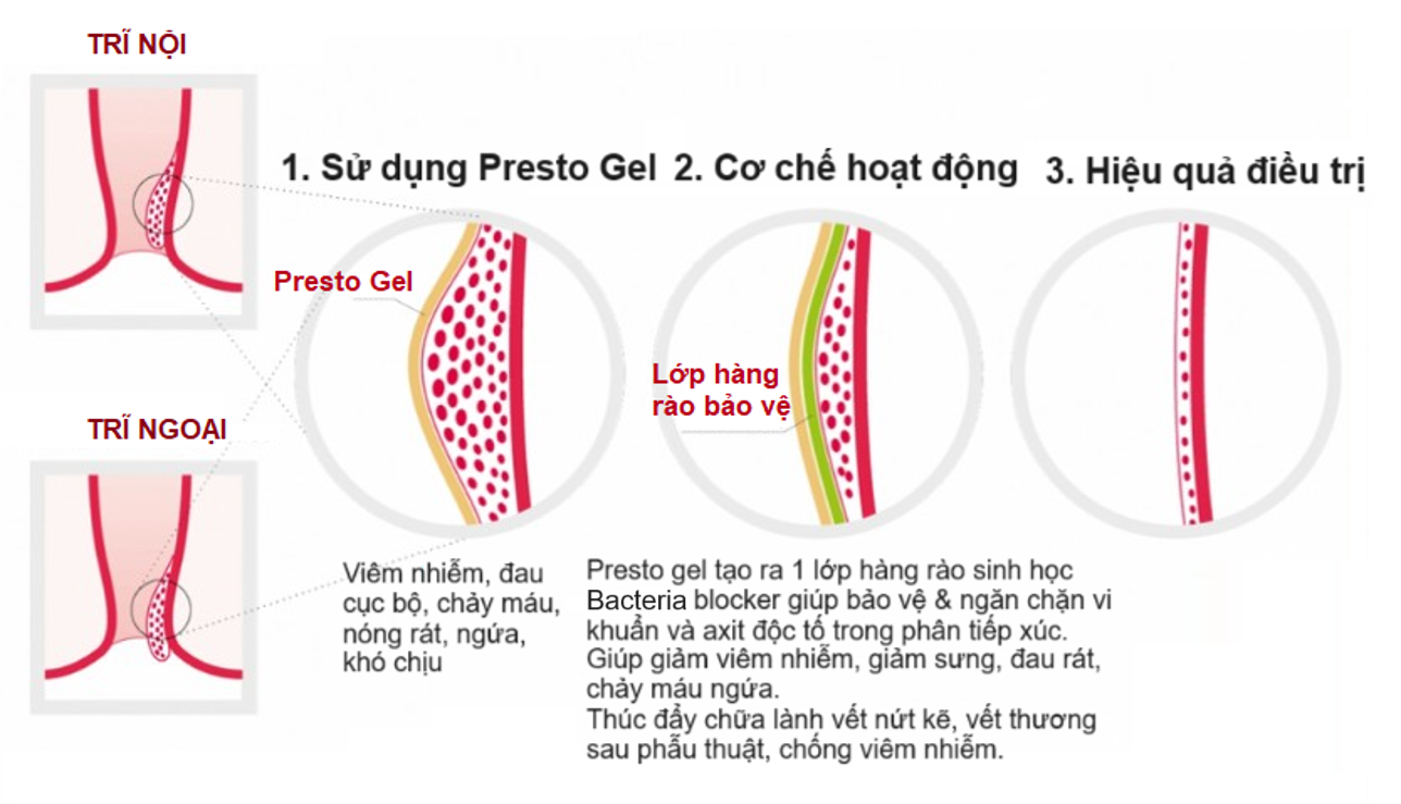 Mô tả Gel trĩ Presto gel giảm nhanh triệu chứng của trĩ, an toàn lành tính cho bà bầu, tuýp 25g, Danpharm Israel - 2