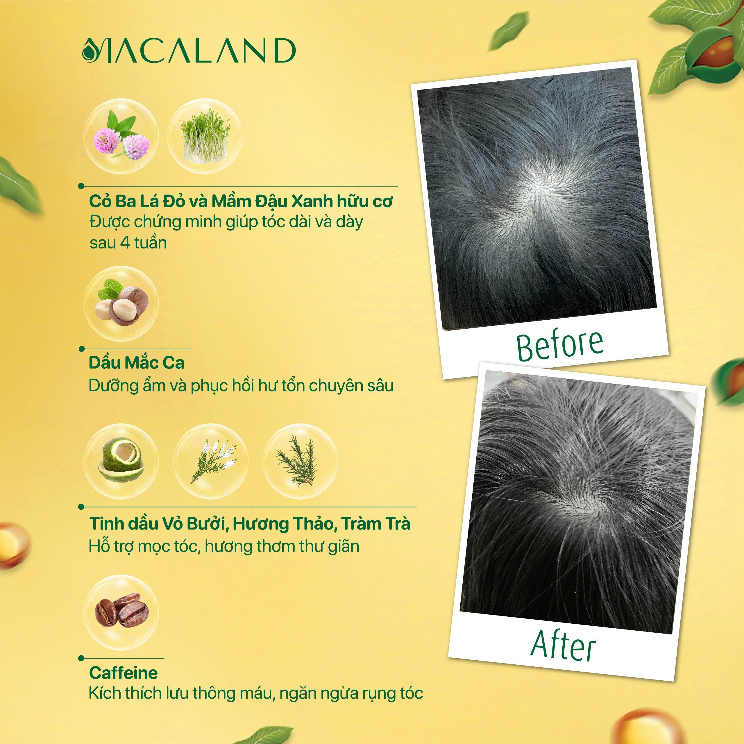 Mô tả Xịt dưỡng tóc Mắc Ca Macaland 30ml/100ml hỗ trợ tóc mọc nhanh giảm tình trạng khô xơ - 2