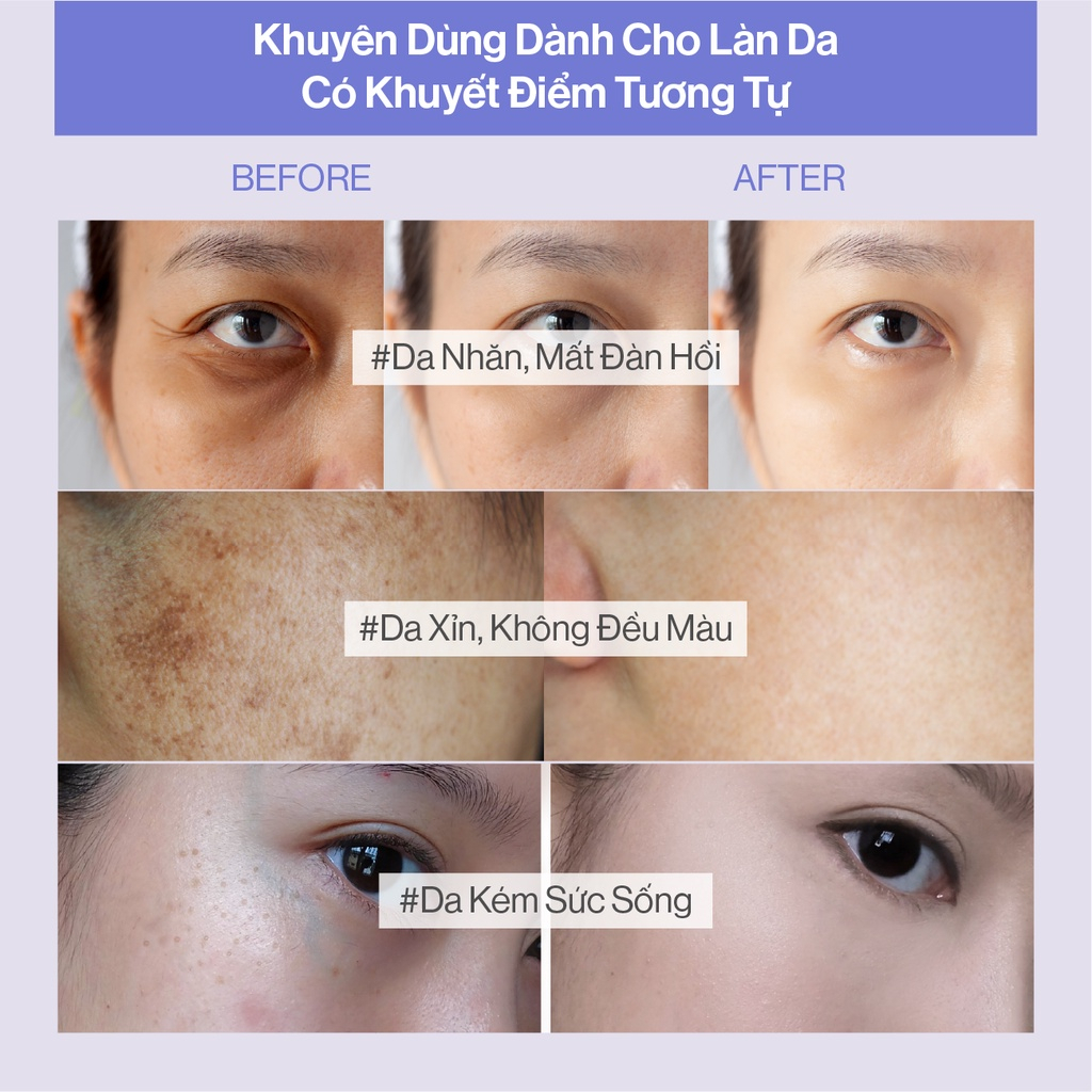 Mô tả Bột Uống Collagen Cao Cấp Kết Hợp Saffron Gilaa (60 gói x 2g) - 2