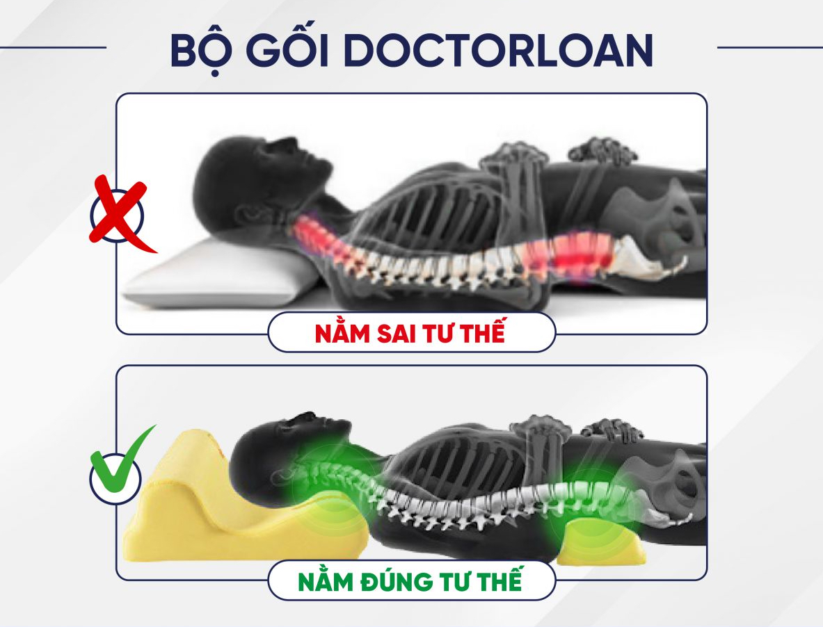 Mô tả GỐI CỔ SÁNG CHẾ DOCTORLOAN F4 bảo vệ đường cong sinh lý nắn chỉnh sai lệch đốt sống - 1