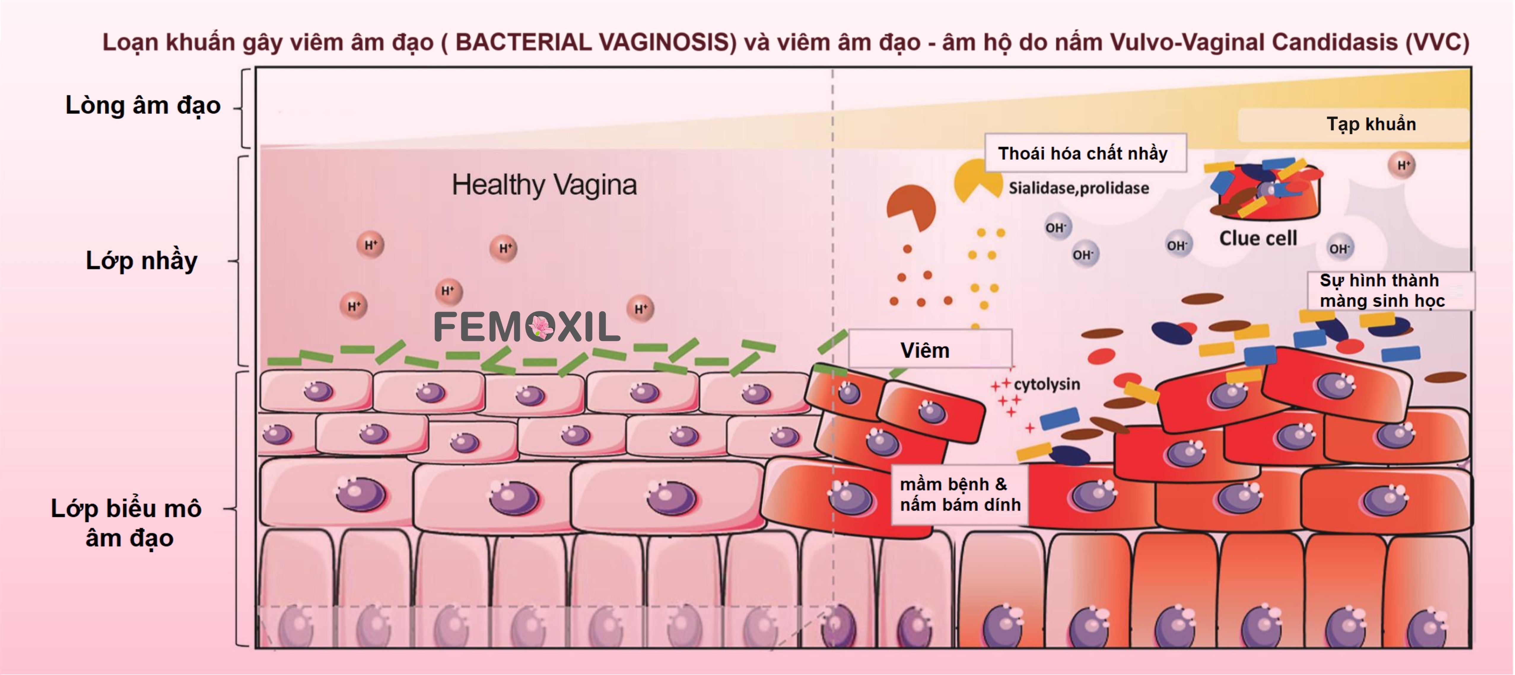 Mô tả Gel bôi nấm ngứa vùng kín FEMOXIL, sạch sâu se khít, hồng hào tự nhiên nhập khẩp danpharm, gói 3g - 1