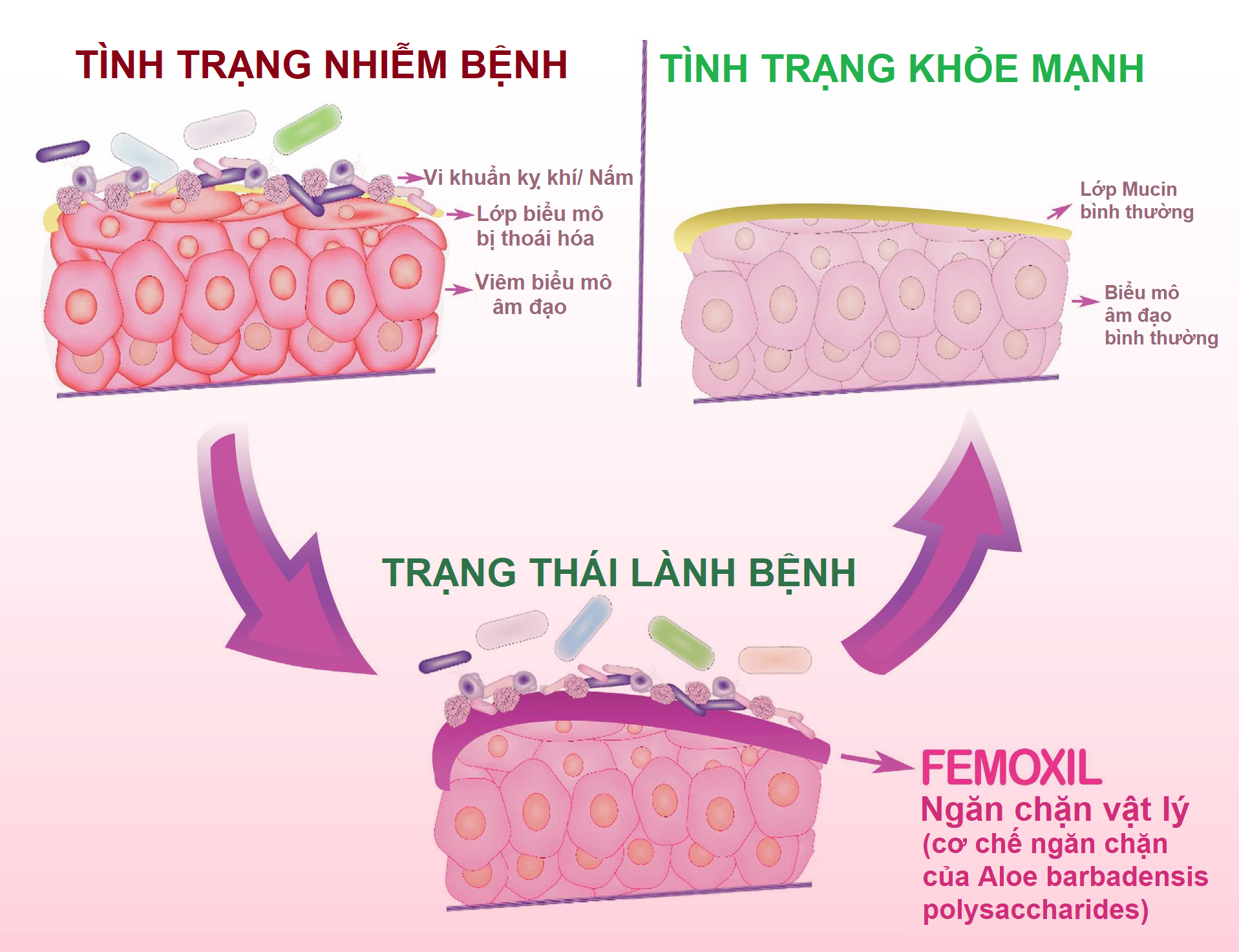 Mô tả Gel bôi nấm ngứa vùng kín FEMOXIL, sạch sâu se khít, hồng hào tự nhiên nhập khẩp danpharm, gói 3g - 2