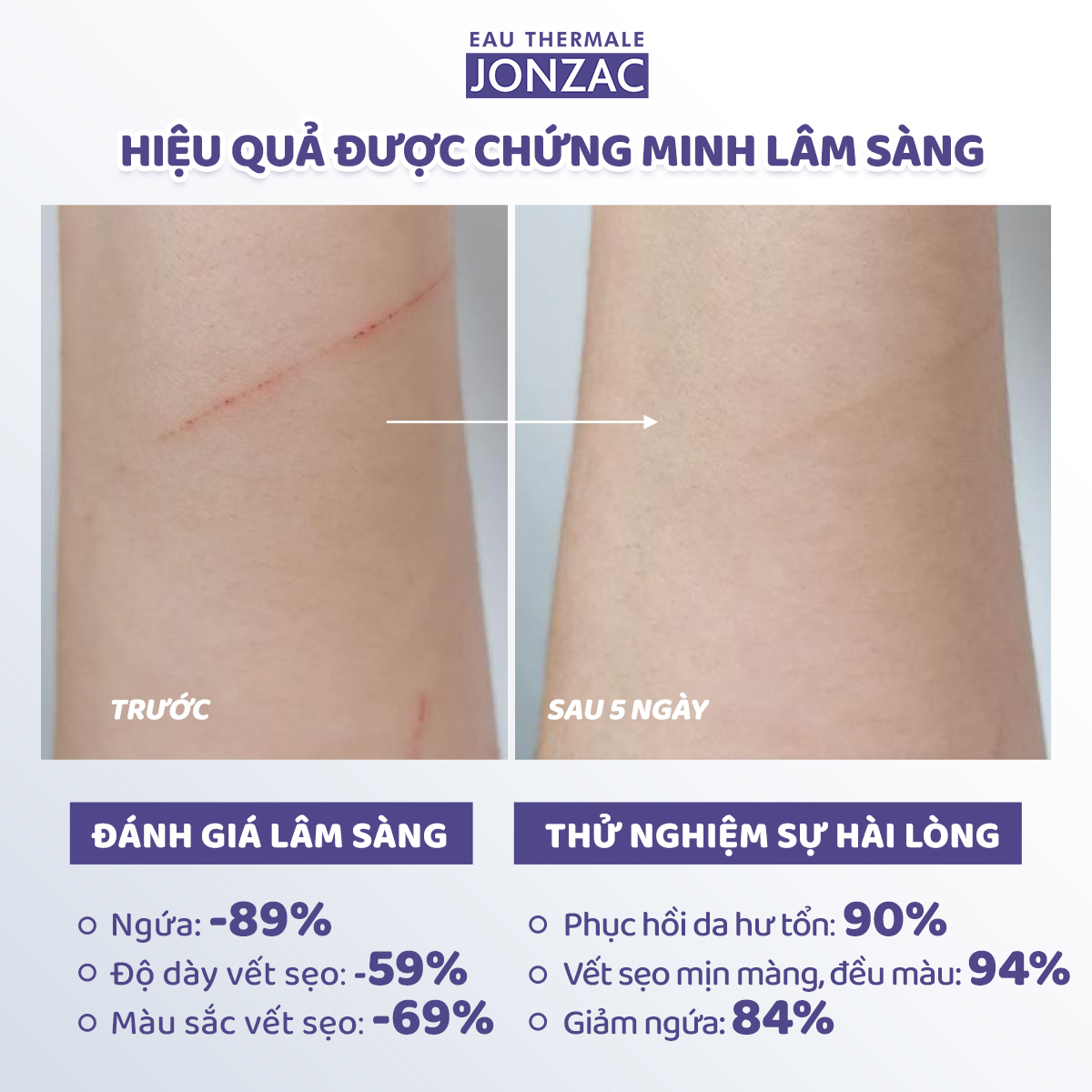 Mô tả Kem làm dịu kích ứng siêu phục hồi hữu cơ CICA JONZAC cho bé và cả gia đình 40ml - 2