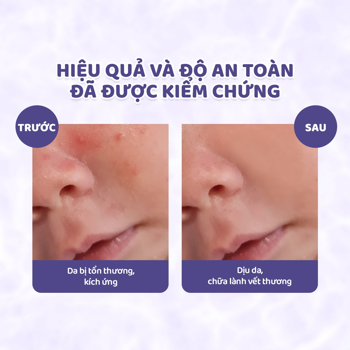 Mô tả Kem làm dịu kích ứng hữu cơ hỗ trợ chống hăm JONZAC dành cho bé từ sơ sinh 40ml - 9
