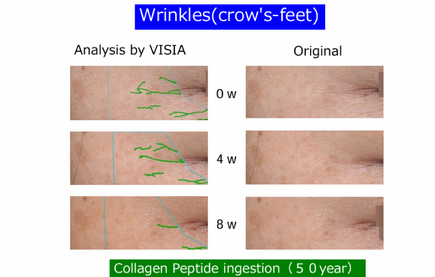 Mô tả Kem Dưỡng Collagen Peptide Kihasu 6in1 Giúp Da Căng Bóng, Trắng Sáng Tự Nhiên, Mờ Nám, Tăng Độ Đàn Hồi Cho Da - 5