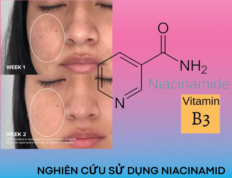 Mô tả Bộ 2 Kem Dưỡng Collagen Kihasu 6in1 Dưỡng Da Trắng Sáng Đều Màu, Cung Cấp Độ Ẩm, Giúp Da Săn Chắc, Đàn Hồi, Trẻ Trung - 3