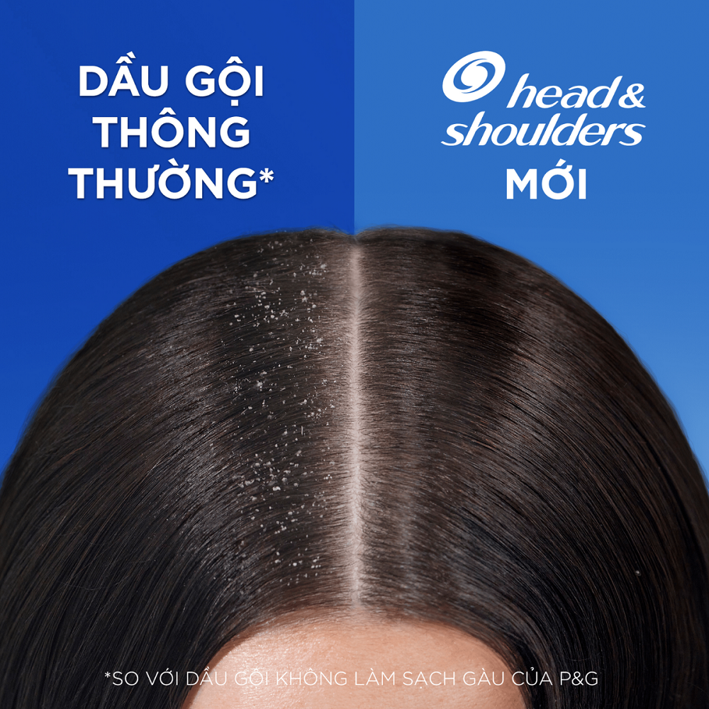 Mô tả Dầu Gội Sạch Gàu HEAD &  SHOULDERS Bạc Hà/ Giảm Ngứa Da Đầu/ Hương Chanh - Chai 1200ML - 4