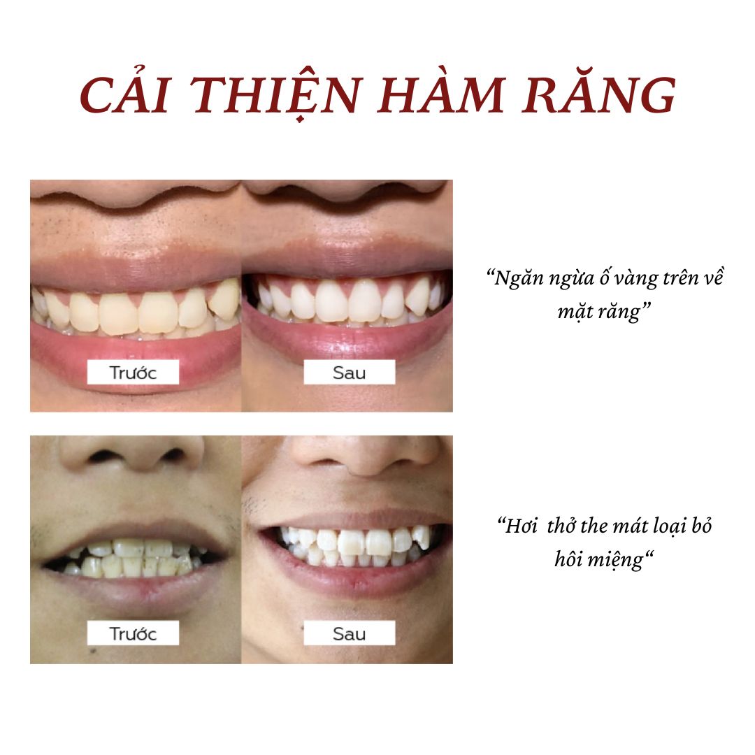 Mô tả Than hoạt tính trắng răng UMIHOME (30g) - Răng trắng với than hoạt tính bột than tre đánh trắng răng - 3