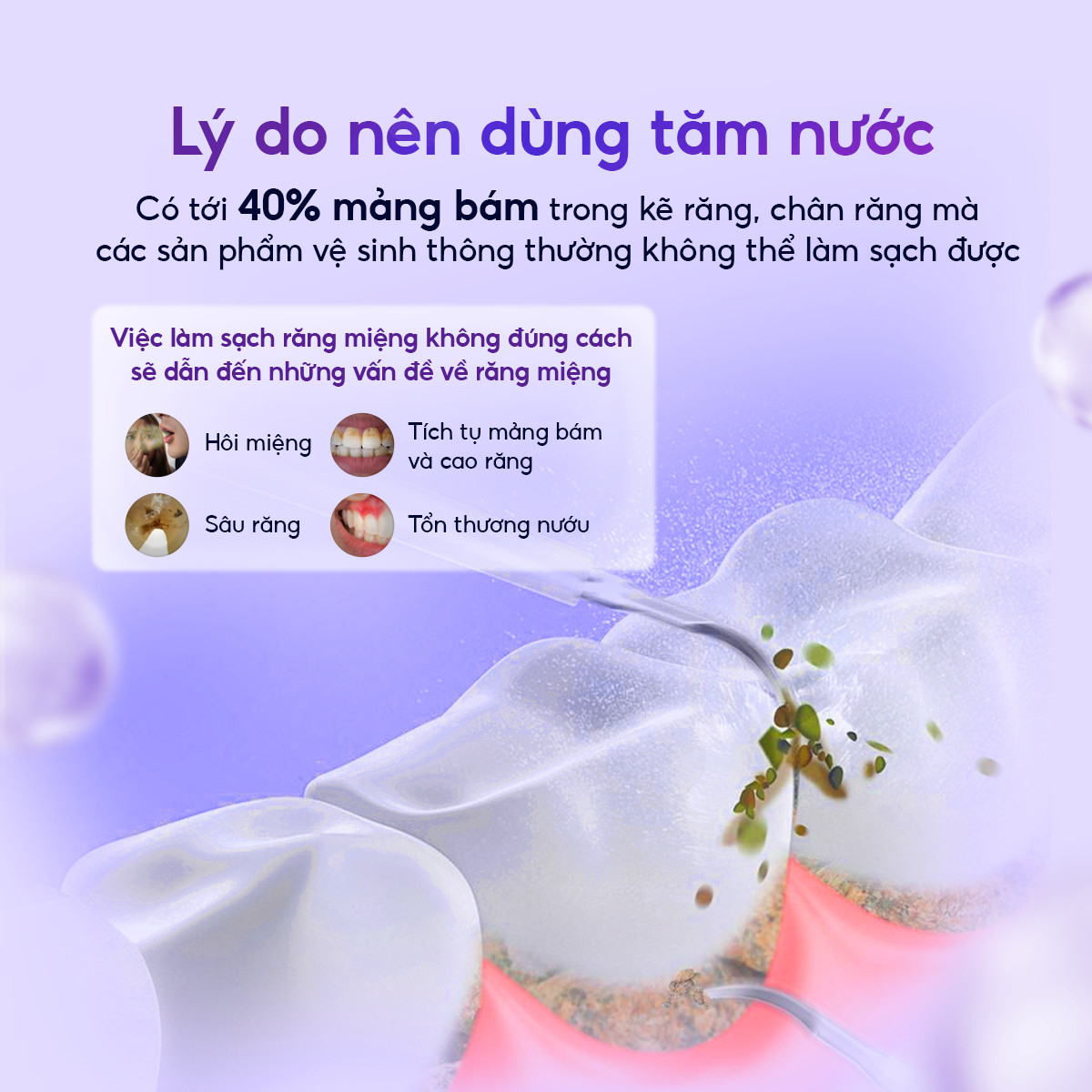 Mô tả Tăm nước brushie thập sắc bản cải tiến làm sạch răng miệng hiệu quả flossie - 2