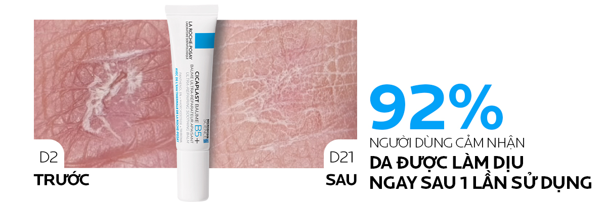 Mô tả Kem dưỡng hỗ trợ làm dịu & phục hồi da La Roche-Posay Cicaplast Baume B5+ 15ml - 5