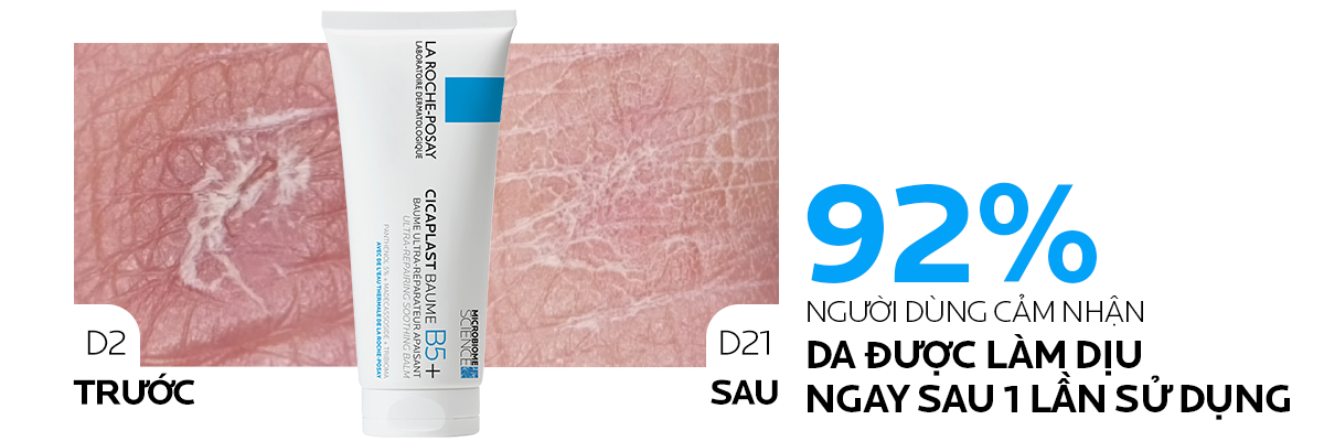 Mô tả Kem phục hồi La Roche-Posay Cicaplast Baume B5+ giúp phục hồi da sau 1 lần sử dụng - phiên bản 100ml - 5