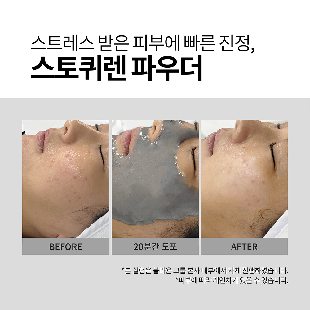 Mặt nạ bột Volayon Stoquiren Powder