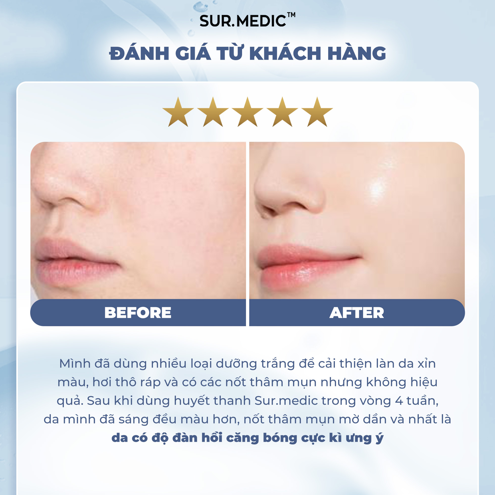 Mô tả Huyết Thanh Dưỡng Trắng SUR.MEDIC Super Glutathione Bright Ampoule 32ml - 6
