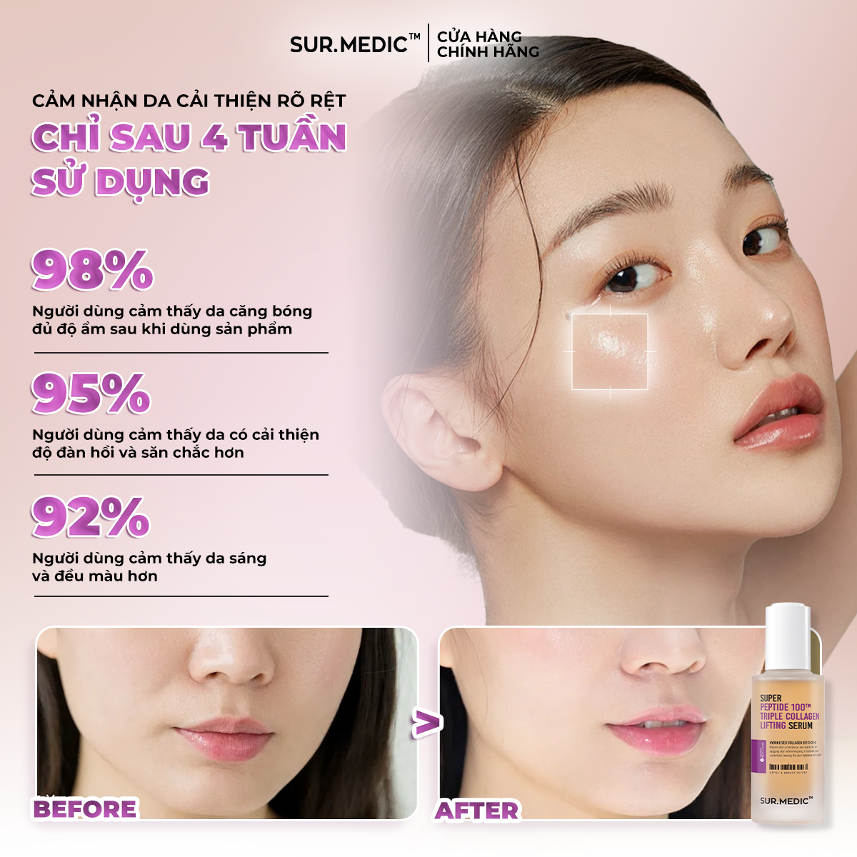 Mô tả Combo Siêu Tinh Chất Và Kem Dưỡng Phục Hồi và Trẻ Khoẻ Da SURMEDIC Super Peptide 100™ Collagen Lifting Serum 100ml - 5