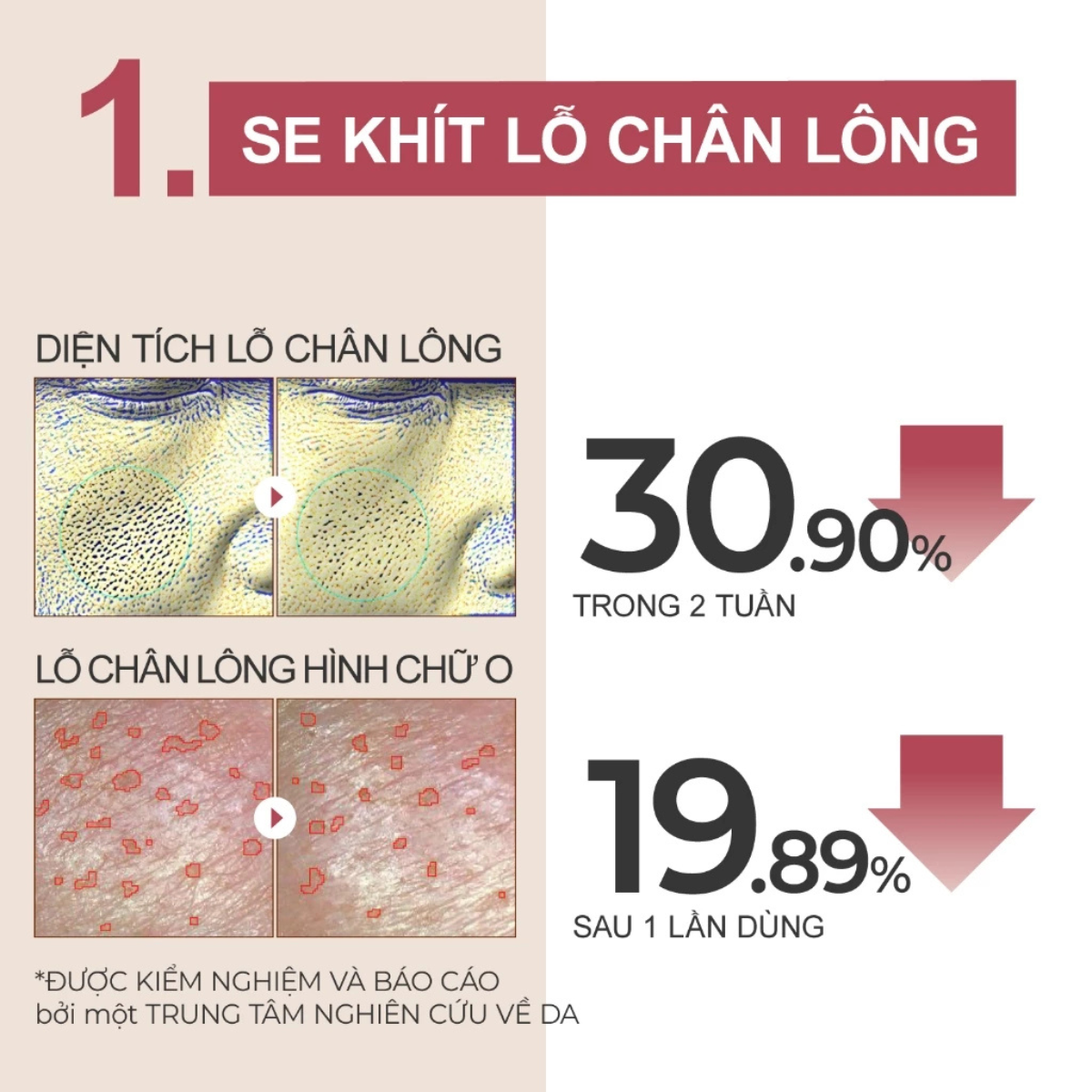 Mô tả Serum Làm Mềm Da Numbuzin No.3 – Phục Hồi Da, Cấp Ẩm Sâu, Dịu Nhẹ Cho Da Nhạy Cảm (50ml) - 2