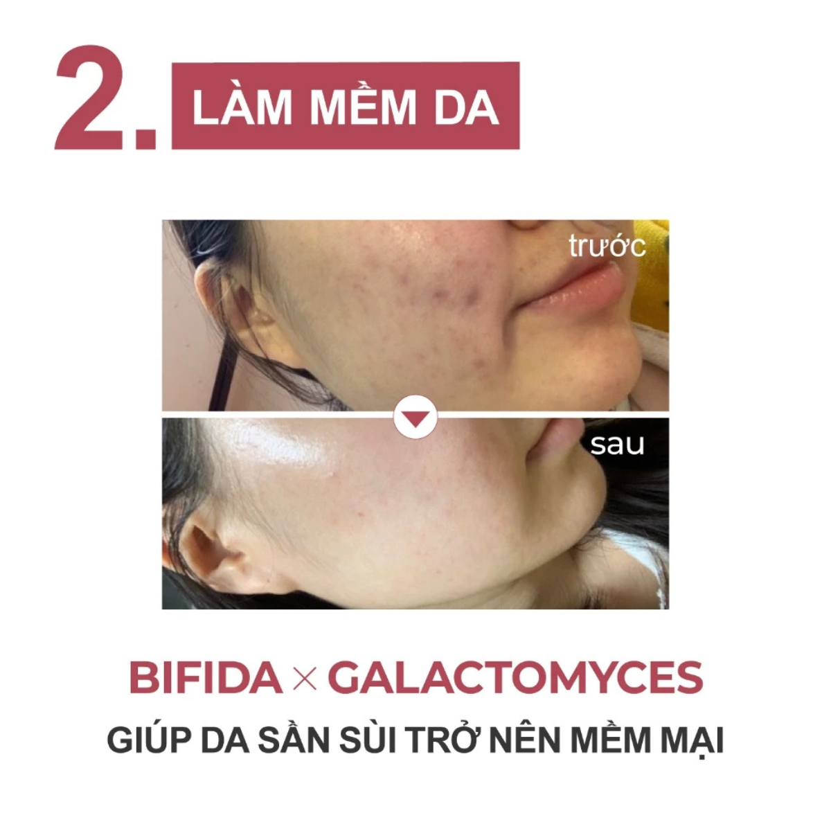 Mô tả Serum Làm Mềm Da Numbuzin No.3 – Phục Hồi Da, Cấp Ẩm Sâu, Dịu Nhẹ Cho Da Nhạy Cảm (50ml) - 3