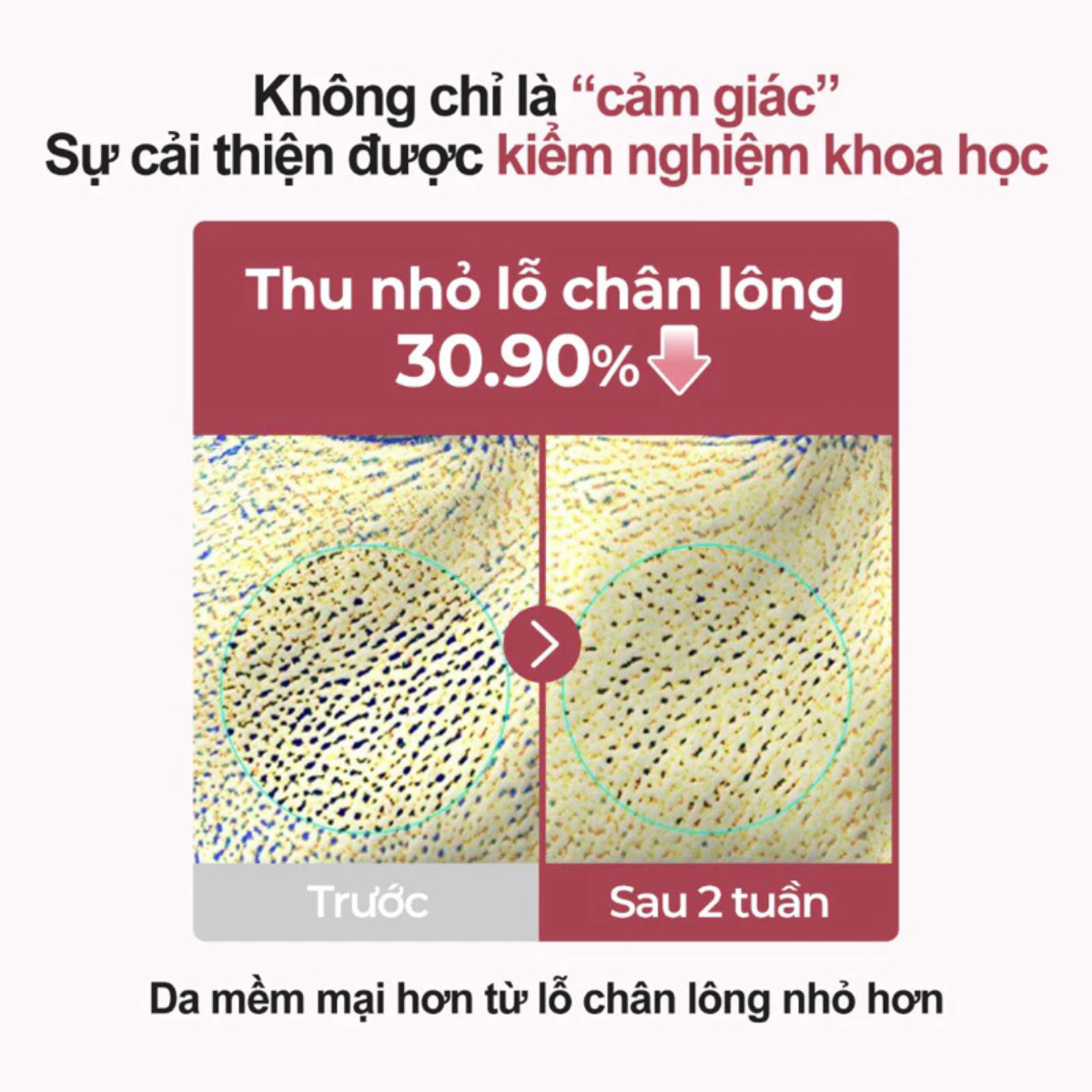 Mô tả Serum Làm Mềm Da Numbuzin No.3 – Phục Hồi Da, Cấp Ẩm Sâu, Dịu Nhẹ Cho Da Nhạy Cảm (50ml) - 5