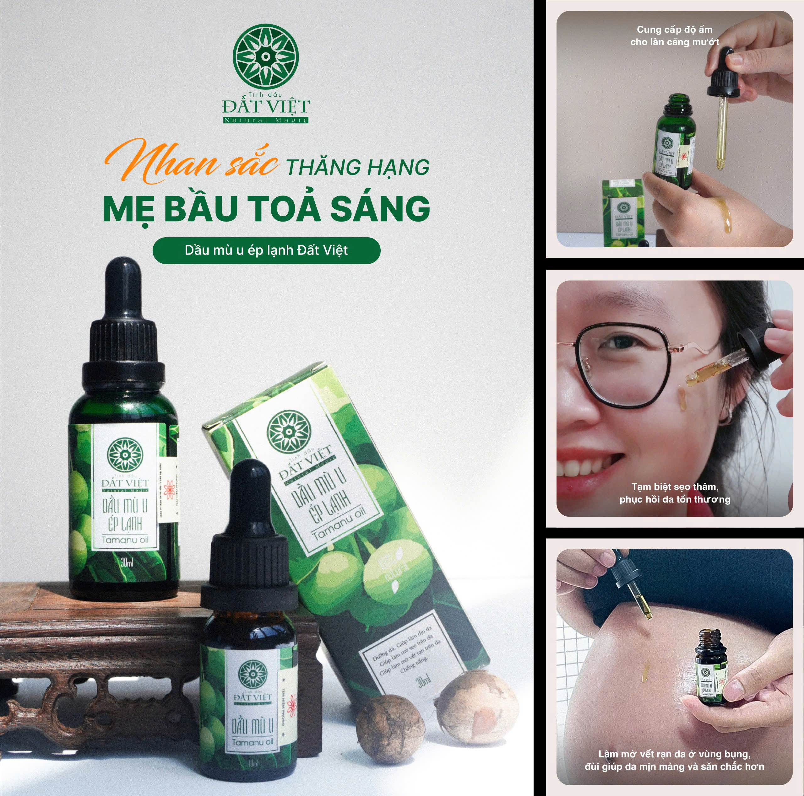 Mô tả Dầu mù u ép lạnh nguyên chất Tinh dầu Đất Việt dung tích 10ml và 30ml - 2