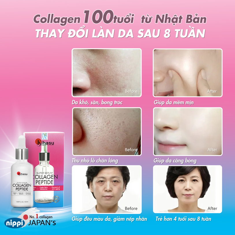 Mô tả Combo Trắng Da Toàn Diện Kihasu Serum Và Kem Dưỡng Sáng Da, Dưỡng Ẩm, Ngăn Lão Hóa, Giảm Thâm, Phục Hồi Da Hư Tổn - 3