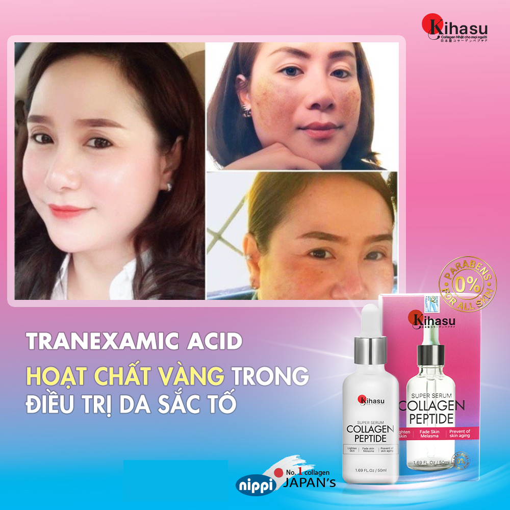 Mô tả Bộ 3 Sản Phẩm Dưỡng Trắng Và Se Khít Lỗ Chân Lông Kihasu Giảm Nếp Nhăn, Chống Lão Hóa, Cấp Ẩm, Cho Da Sáng Hồng Rạng Rỡ - 3