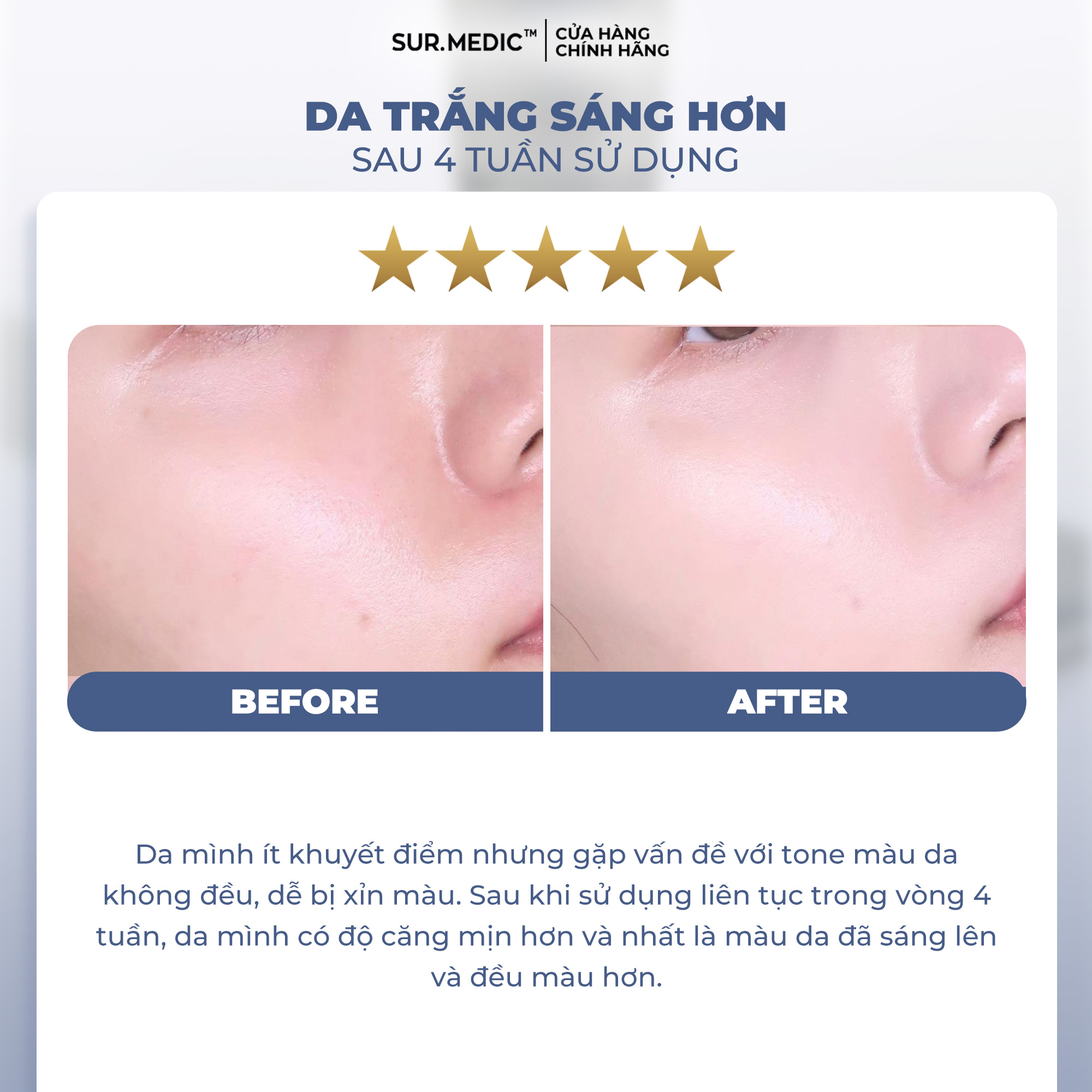 Mô tả Kem Dưỡng Nâng Tông Trắng Da SUR.MEDIC Super Glutathione 100 Bright Tone Up Cream 40ml - 5
