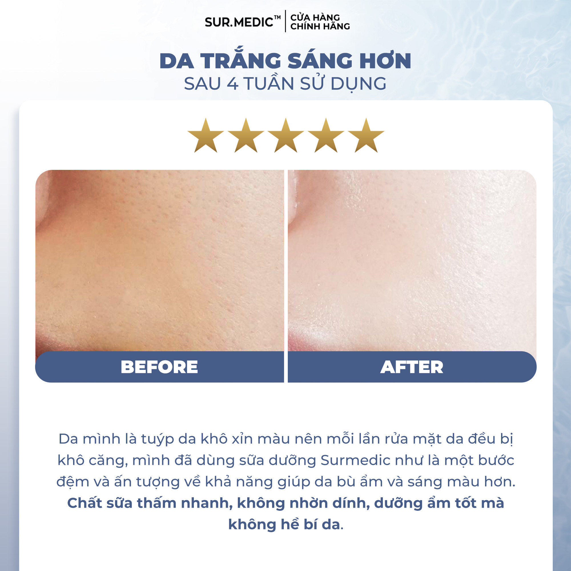 Mô tả Nước Thần Dưỡng Trắng Dạng Sữa SUR.MEDIC Super Glutathione Bright Emulsion 120ml - 5