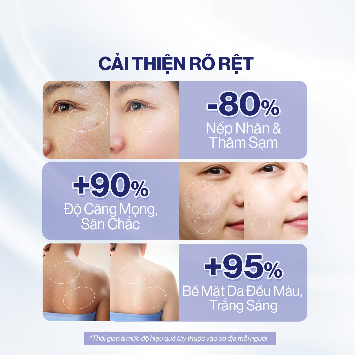 Mô tả Combo Căng Bóng Trắng Da Bột Ngậm Glutathione C (3g x 30 gói) và Bột Uống Collagen Gilaa (2g x 60 gói) - 3