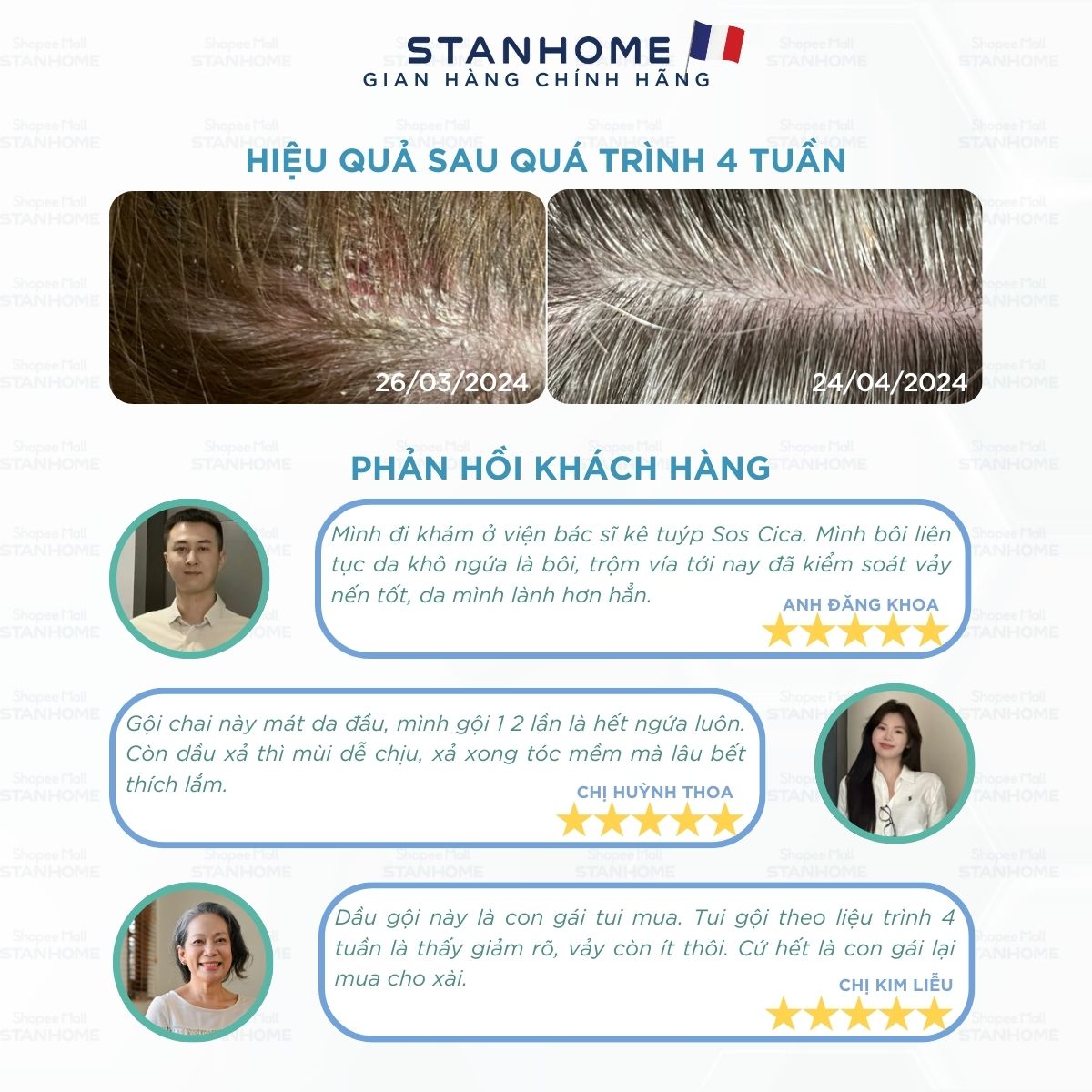 Mô tả Combo viêm da đầu tiết bã Stanhome Balance Shampoo-Sos Cica-Gentle shampoo - Gentle Conditioner - 3