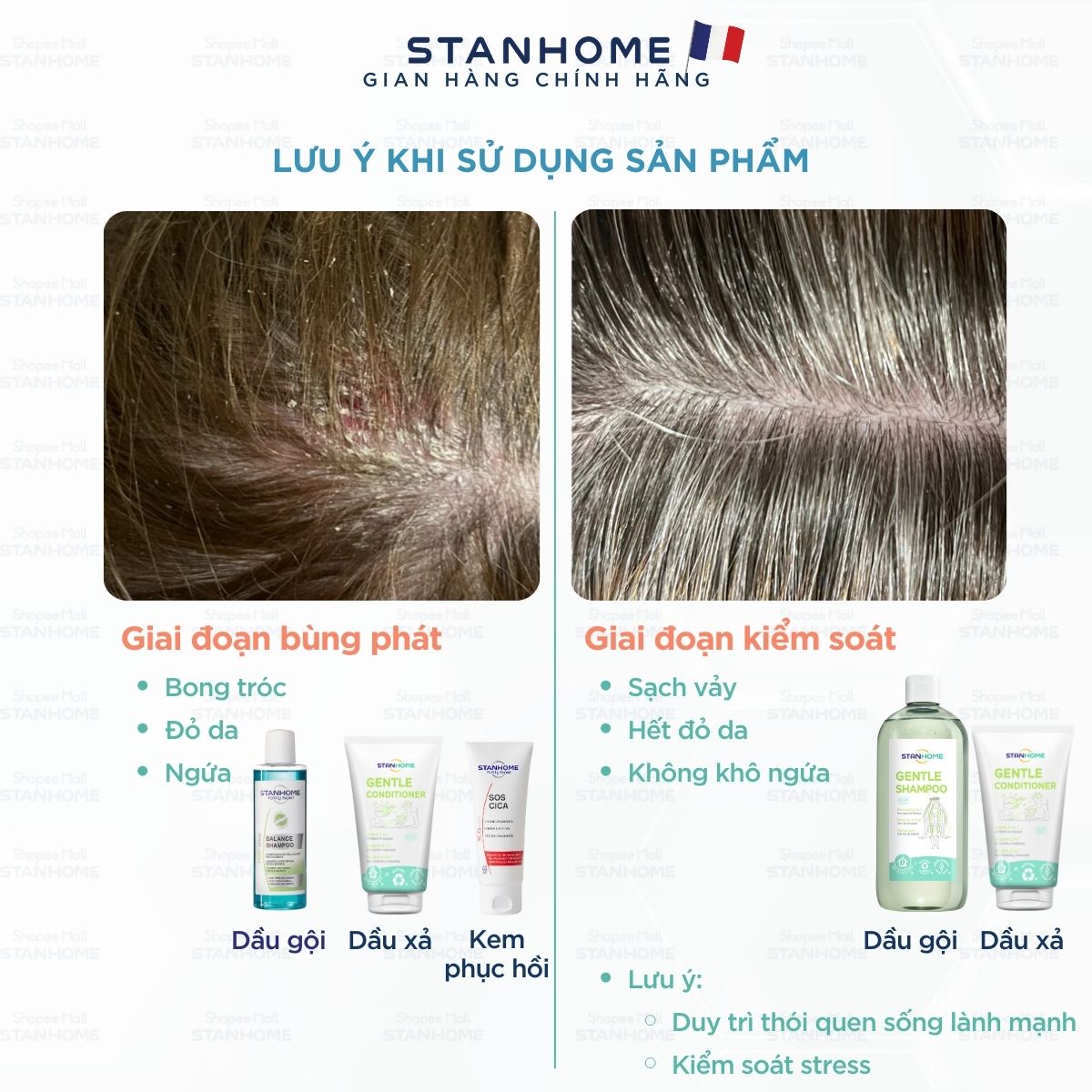 Lợi ích của Combo Stanhome