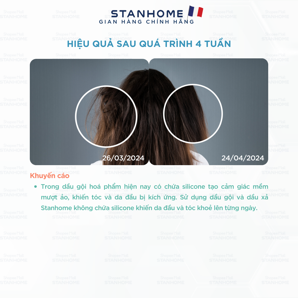 Mô tả Combo viêm da đầu tiết bã Stanhome Balance Shampoo-Sos Cica-Gentle shampoo - Gentle Conditioner - 2