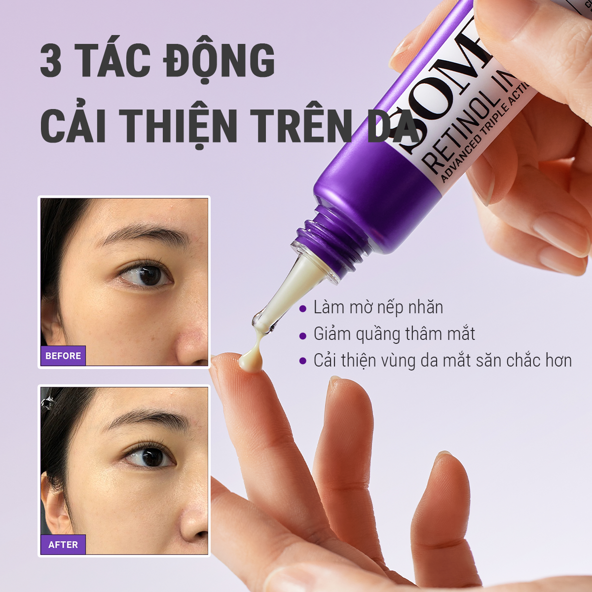 Mô tả Kem dưỡng mắt Some By Mi Retinol 0.1% Intense Advanced Triple Action Eye Cream 30ml giảm quầng thâm và nếp nhăn - 2