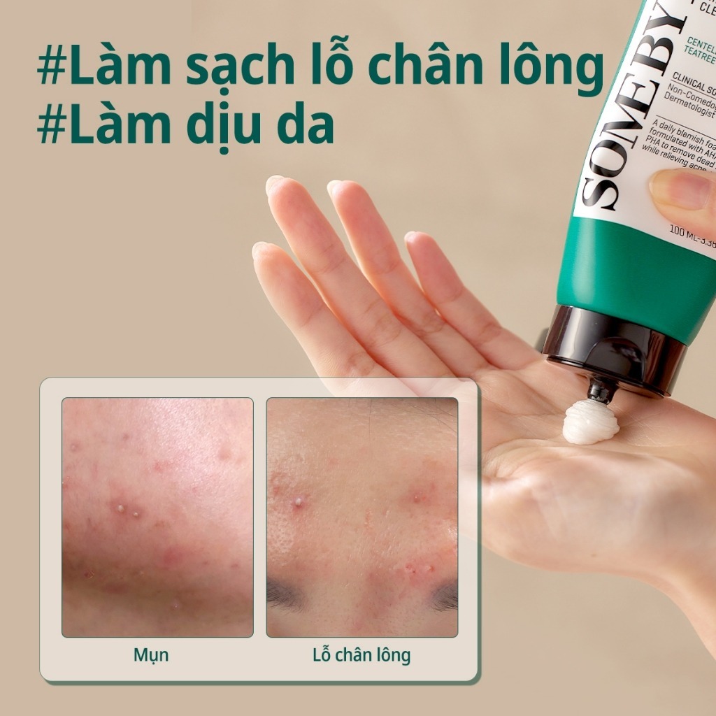 Mô tả Some By Mi Sữa rửa mặt dịu nhẹ AHA-BHA-PHA 30 Days Miracle Acne Clear Foam 100ml - 2
