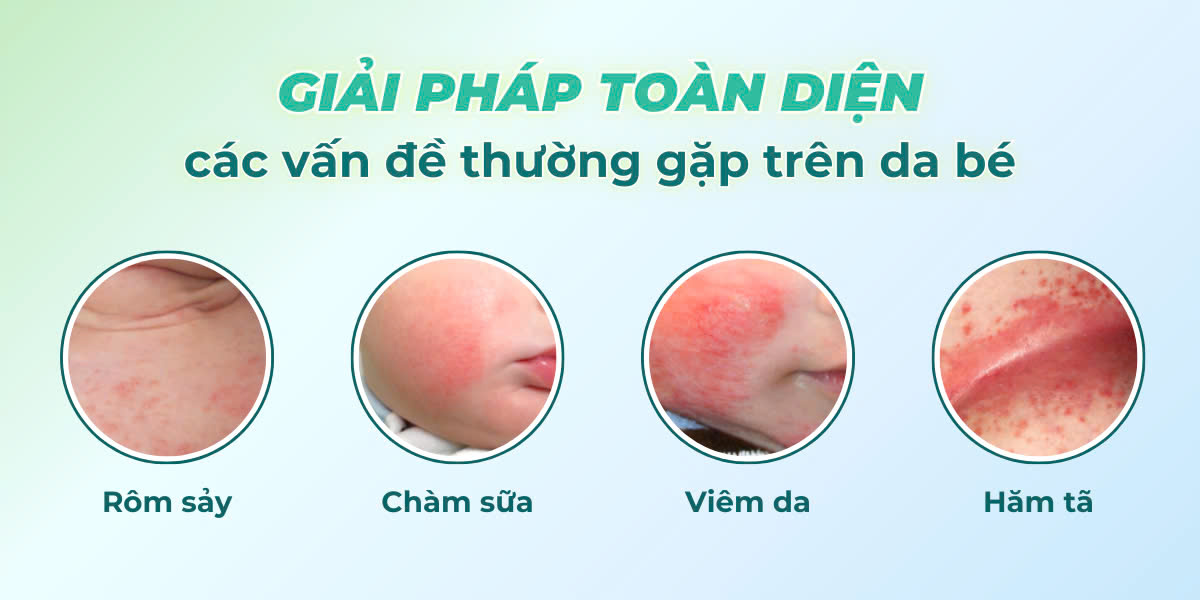 Mô tả Bath Sea Salt Muối tắm cho bé Sinh Dược Eco Gold 370g- Combo 3 tặng 1 - 3