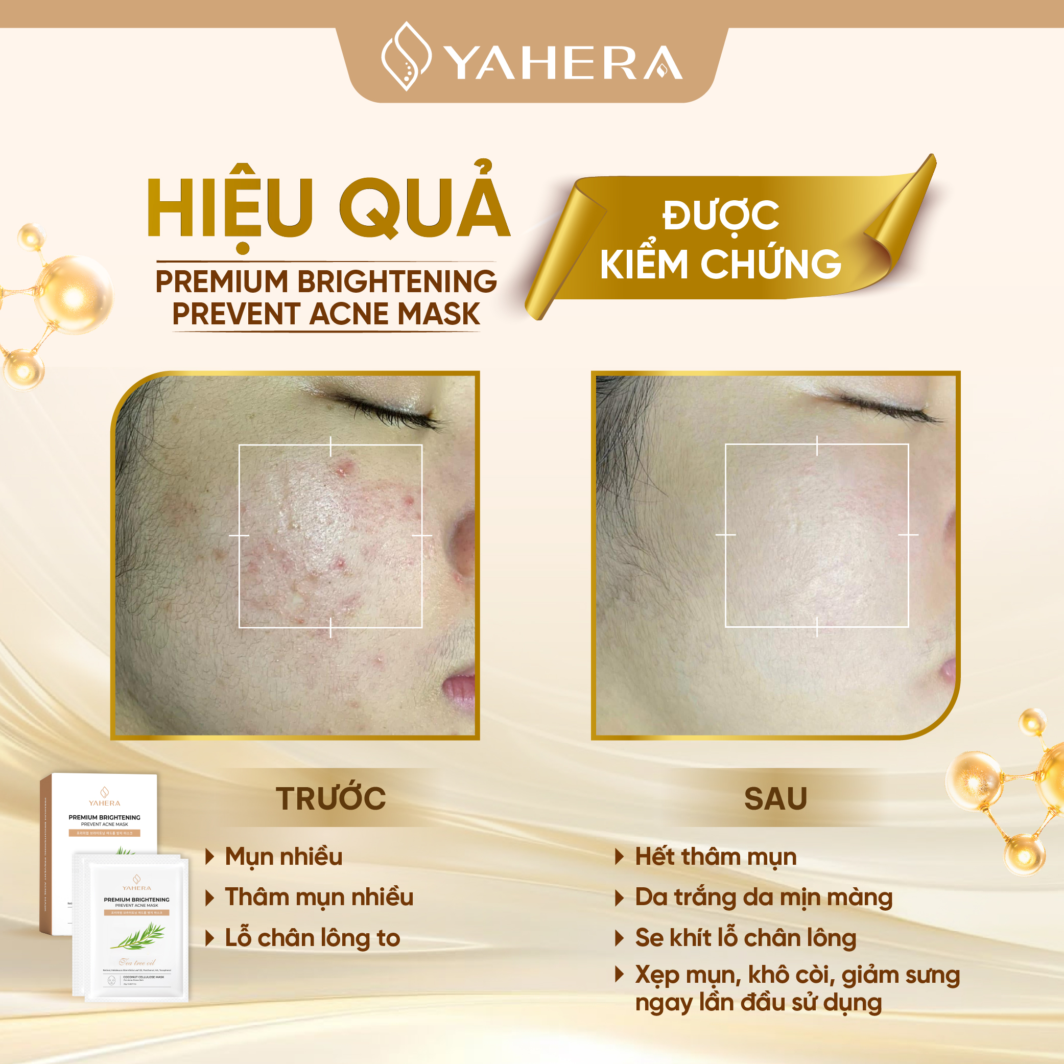 vn 11134208 7ra0g