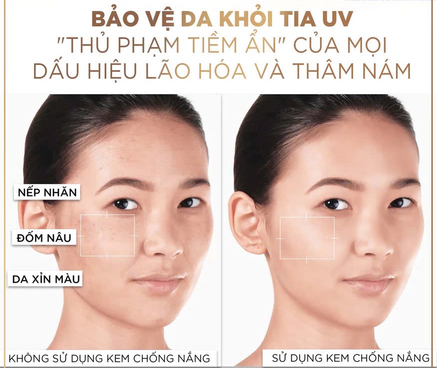 vn 11134208 7ra0g