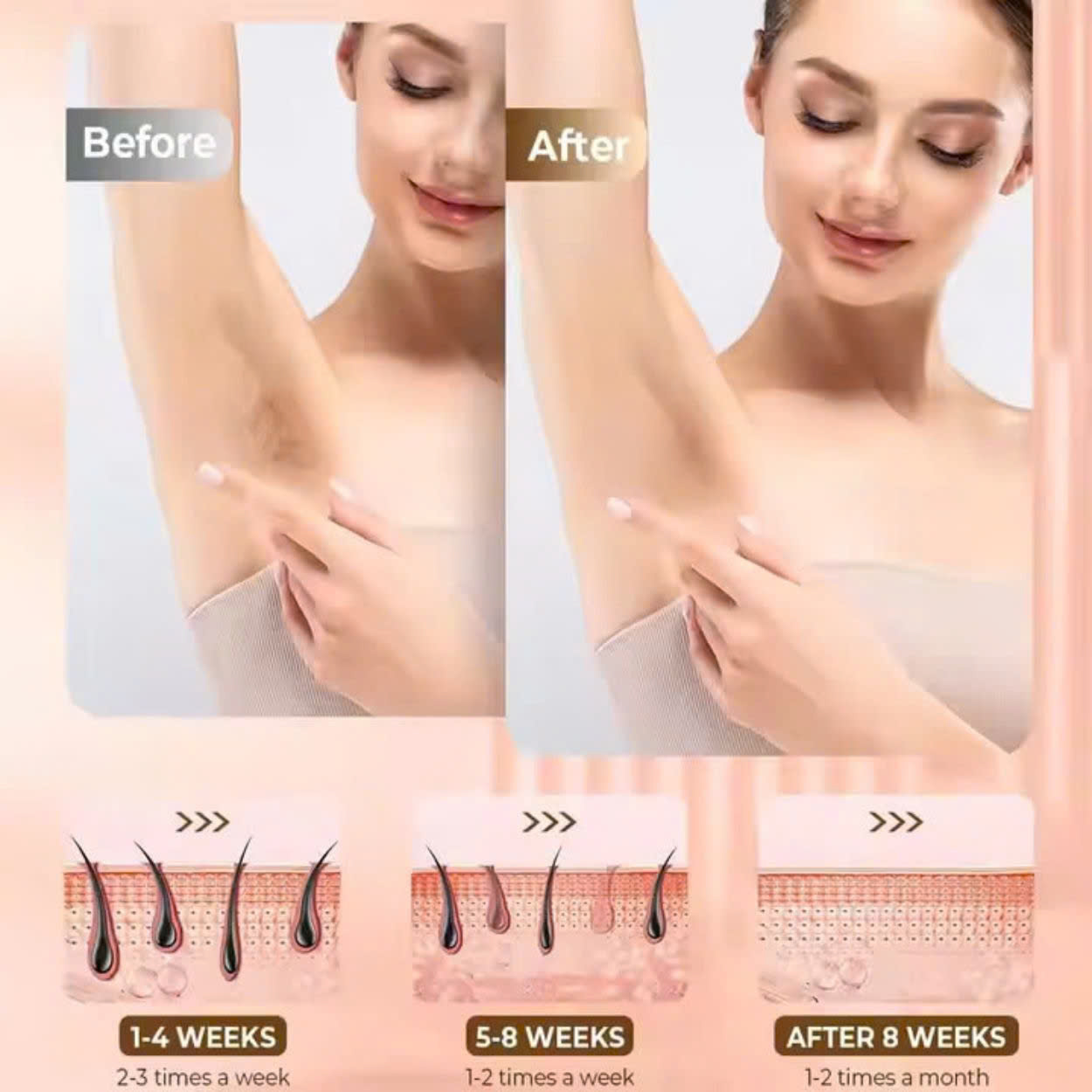 Mô tả Máy triệt lông ENZO cao cấp, công nghệ IPL giảm thâm trẻ hóa da, triệt lạnh ICE, Bảo Hành 10 Năm - 3