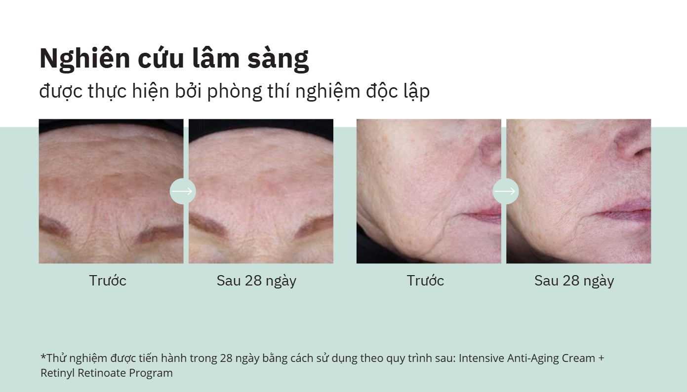 Mô tả Liệu trình Retinoate 28 ngày với huyết thanh chống lão hóa – Retinol thế hệ mới | Retinoate Program - 1