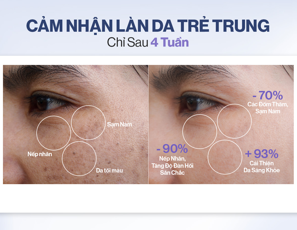 Mô tả 2 Nước Uống Collagen Gilaa Siêu Phân Tử 300da Trẻ Hóa (20g x 30 Gói) - 2