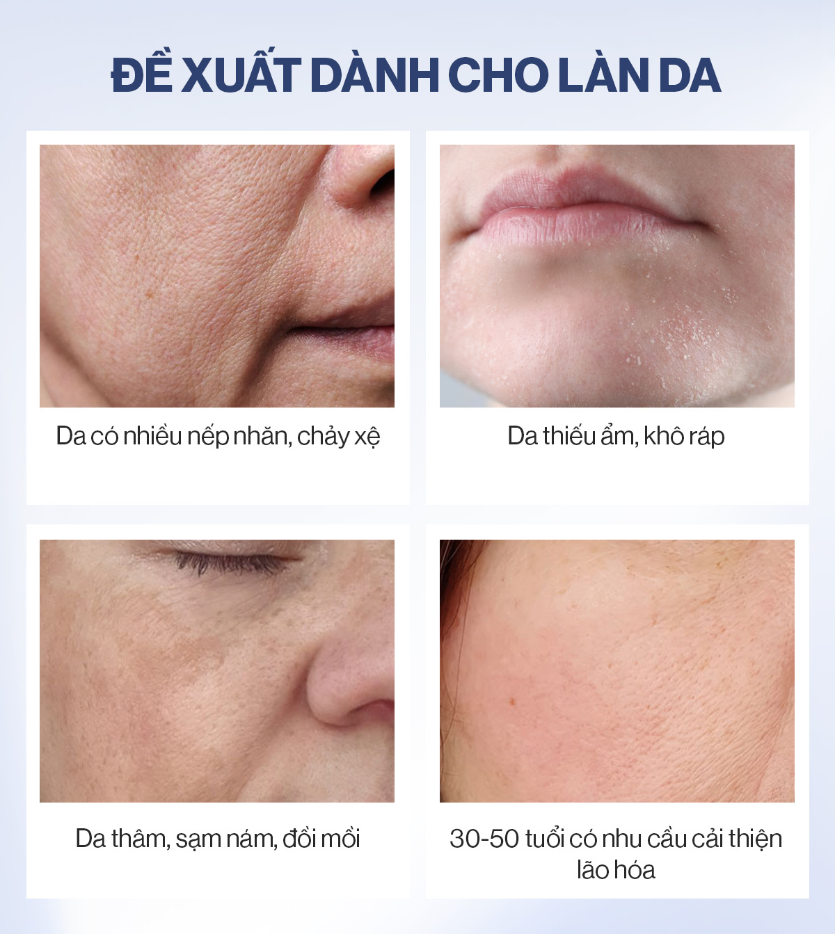 Mô tả 2 Nước Uống Collagen Gilaa Siêu Phân Tử 300da Trẻ Hóa (20g x 30 Gói) - 3