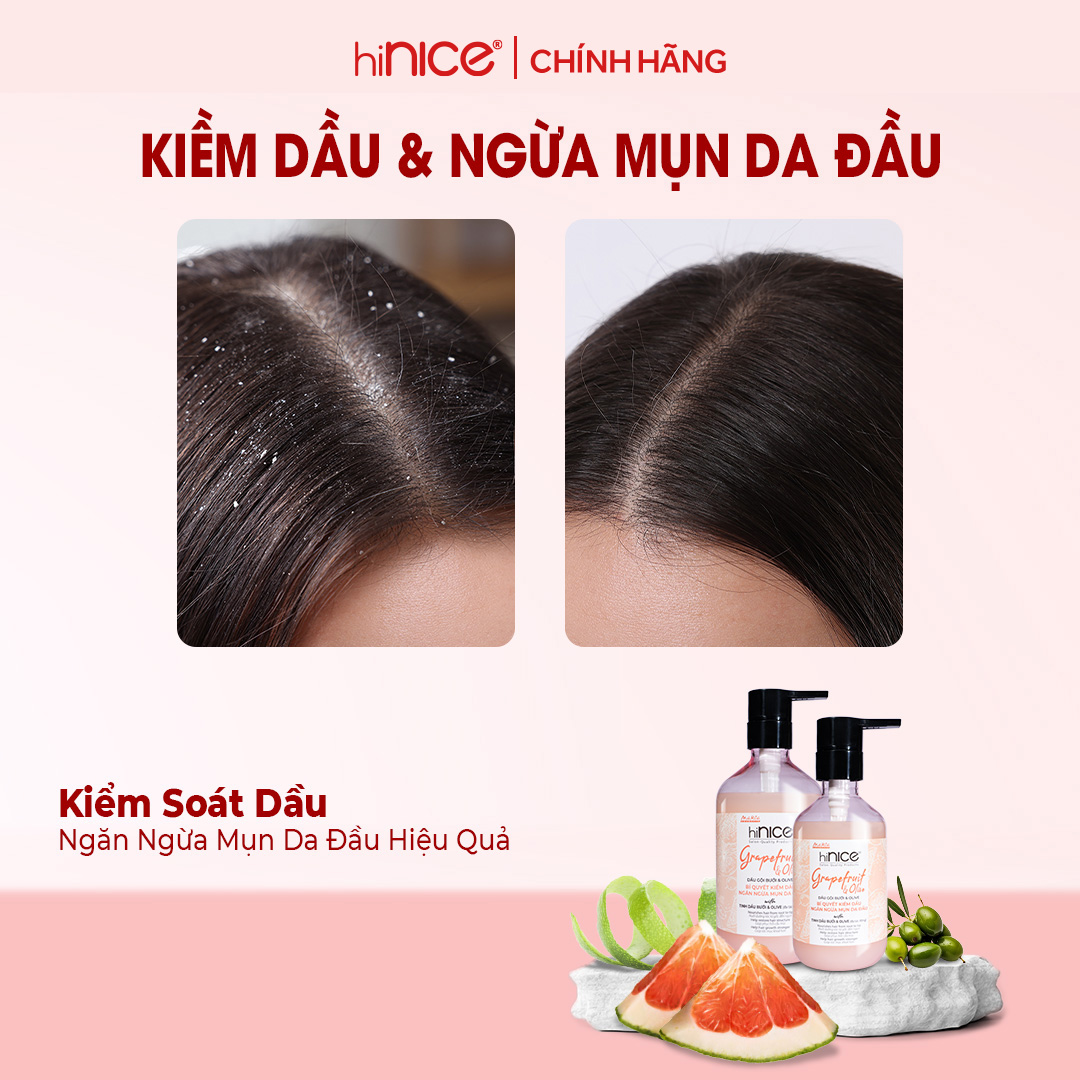 Mô tả Bộ Gội Xả Tinh Dầu Bưởi Hồng Olive hiNICE Grapefruit & Olive Shampoo Hỗ Trợ Giảm Mụn Da Đầu - 1