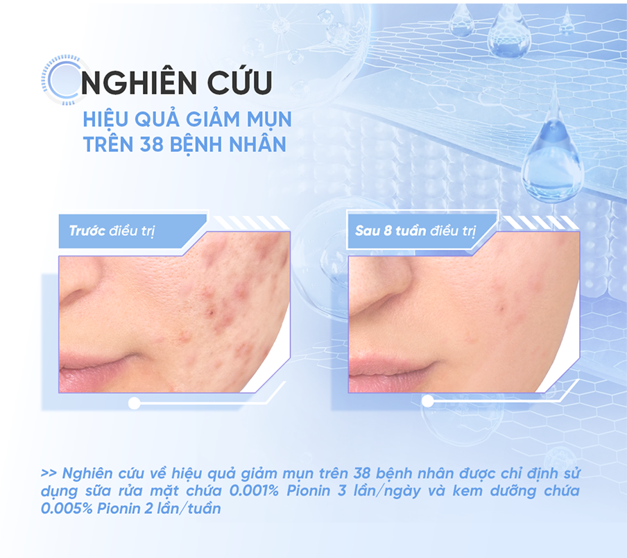 Mô tả [KOL LIVE] Dung Dịch Tẩy Tế Bào Chết All Target Skin Renewing Solution Pionin + 12% AHA/BHA/PHA 120ml - 11