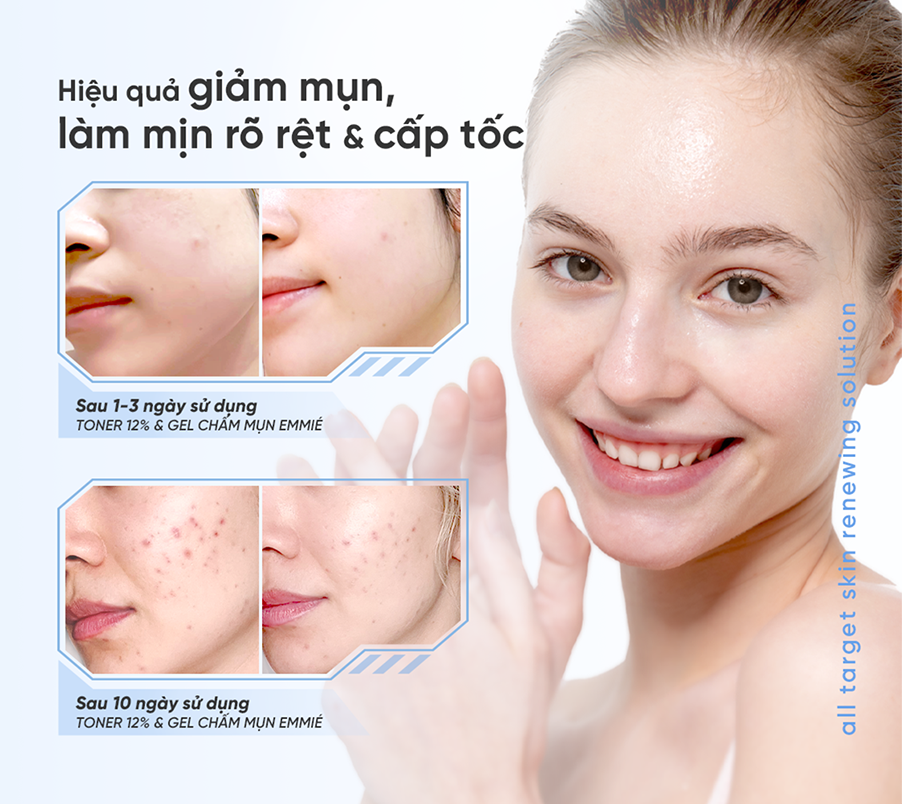 Mô tả [KOL LIVE] Dung Dịch Tẩy Tế Bào Chết All Target Skin Renewing Solution Pionin + 12% AHA/BHA/PHA 120ml - 12