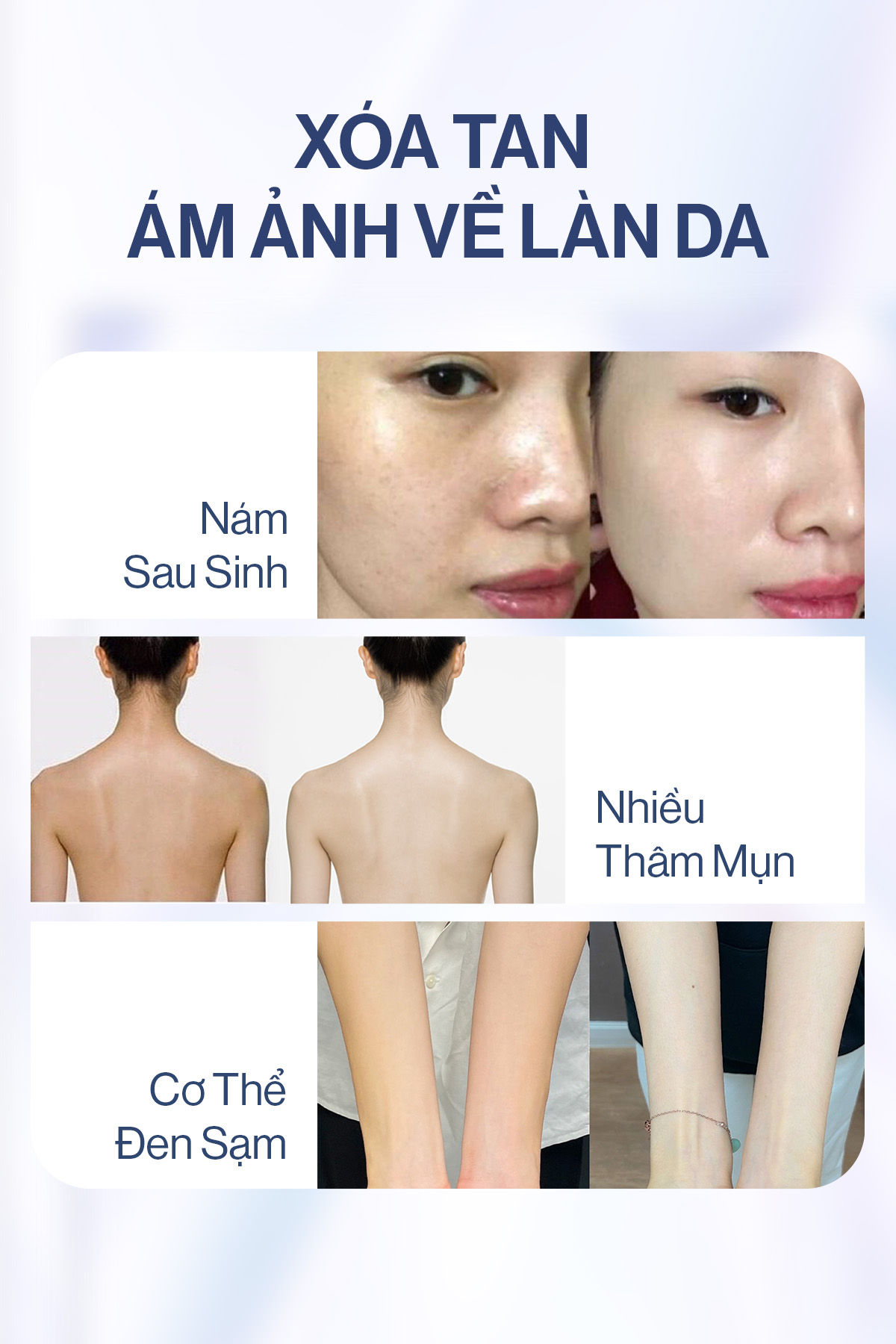 Mô tả Bột Ngậm Trắng Da Toàn Thân Glutathione C GILAA (3g x30 gói) - 3