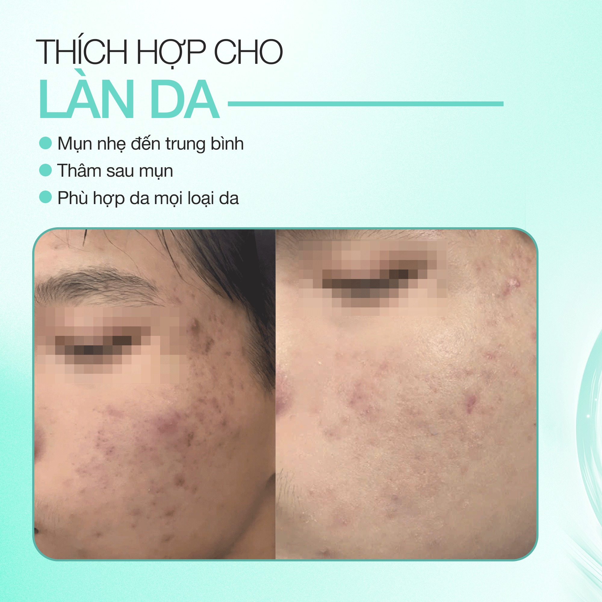 Mô tả Dung Dịch Peel Trẻ Hóa, Căng Bóng Da Và Ngừa Mụn Luminclear Perfection Peel Solution 2ml - 4