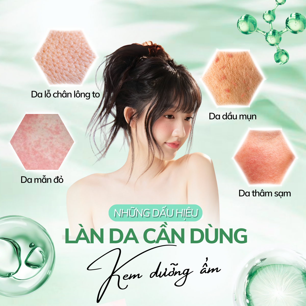 Mô tả Kem Dưỡng Azelaic Acid Compliment Giảm Dầu Mụn, Mờ Thâm, Sáng Da 35ml - 6